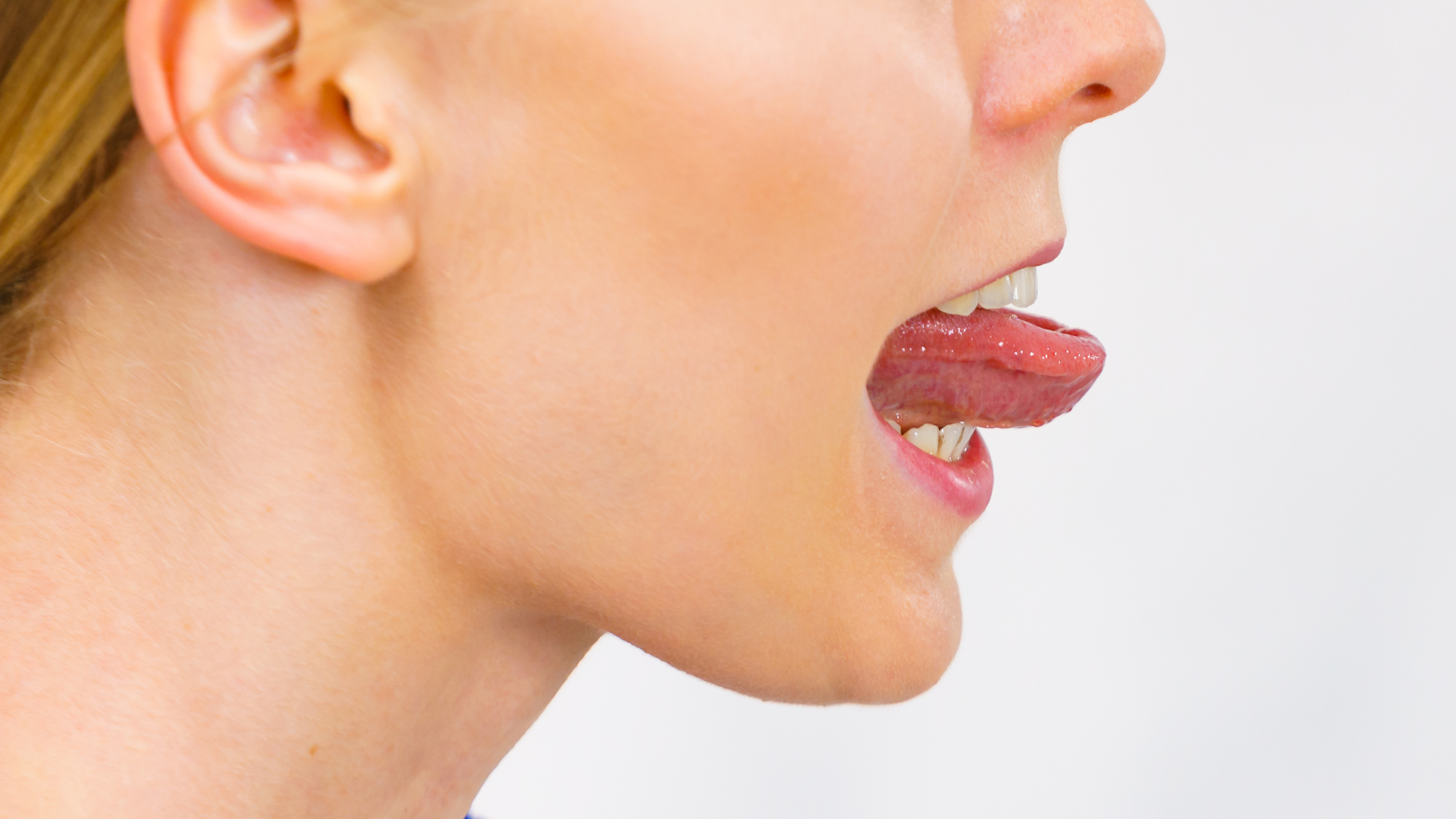 Adult Tongue Tie: Signs, Symptoms, and When to Seek Help