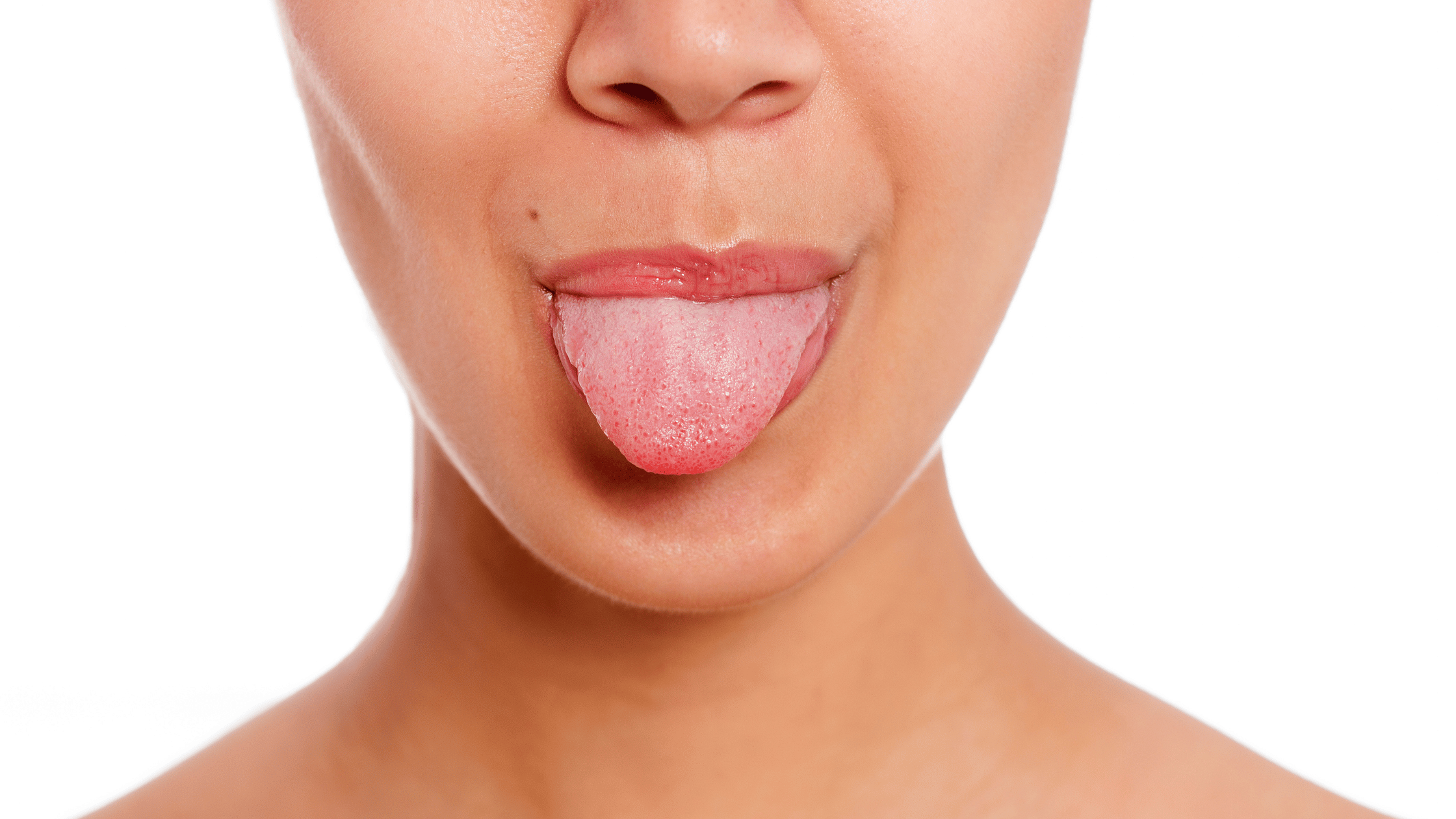 10 Signs You May Have an Adult Tongue Tie
