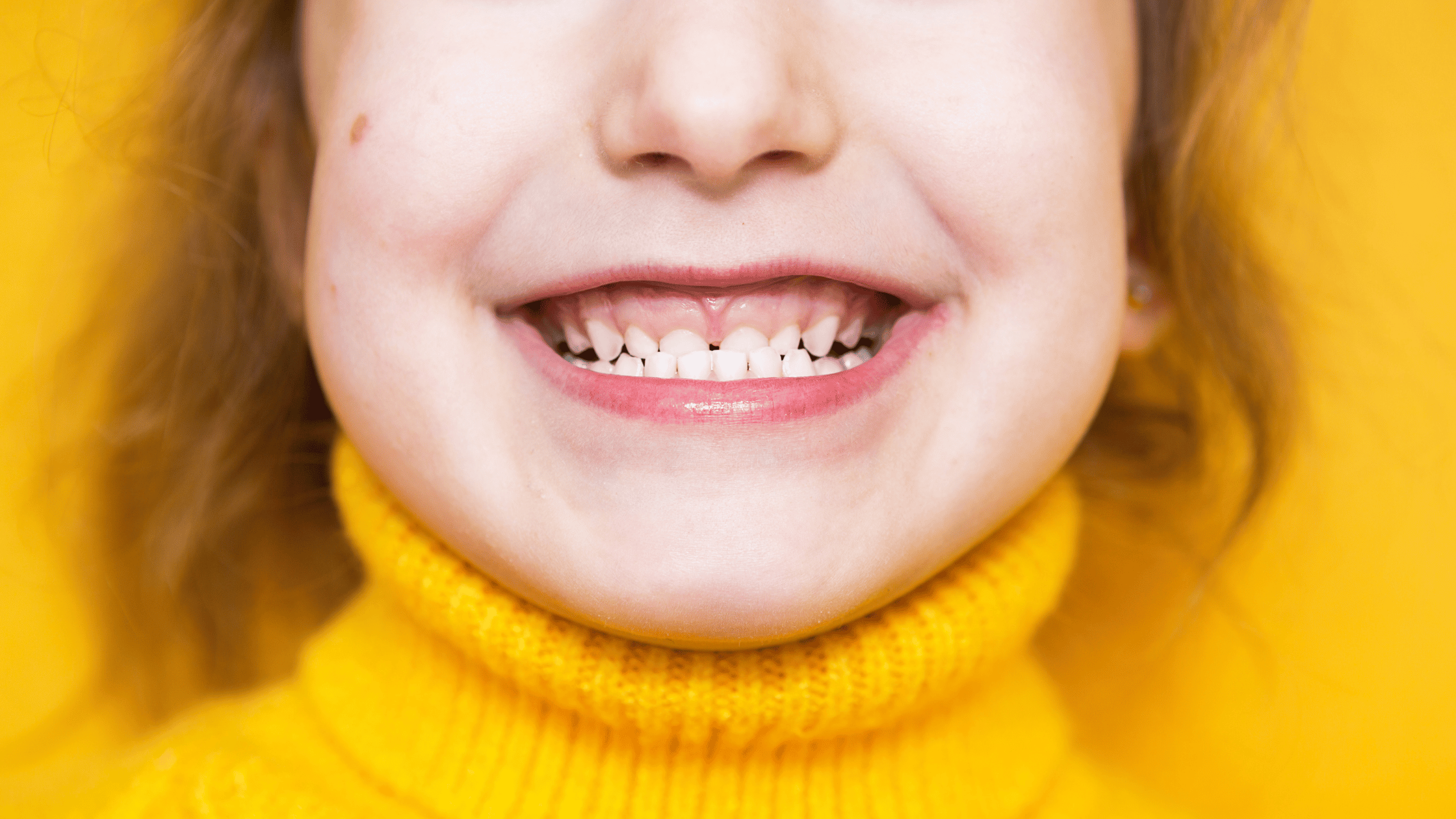 What Is an Orofacial Myofunctional Disorder? (OMD Explained for Parents)