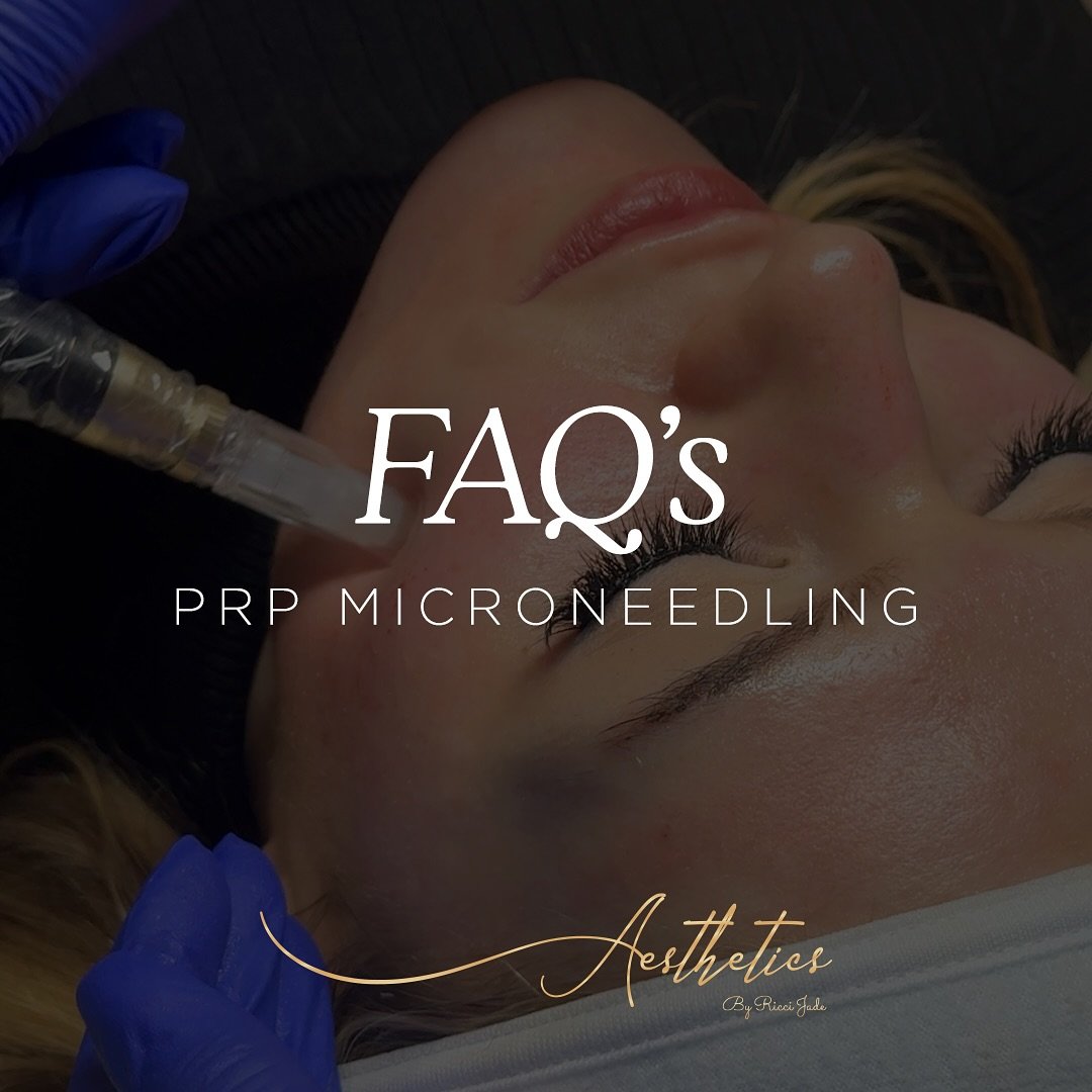 Discover the benefits of PRP Microneedling! ✨

Whether you&rsquo;re looking to rejuvenate your skin or promote hair growth, this natural, effective treatment could be just what you need. 

Swipe through our FAQs to learn more or DM us to book your co