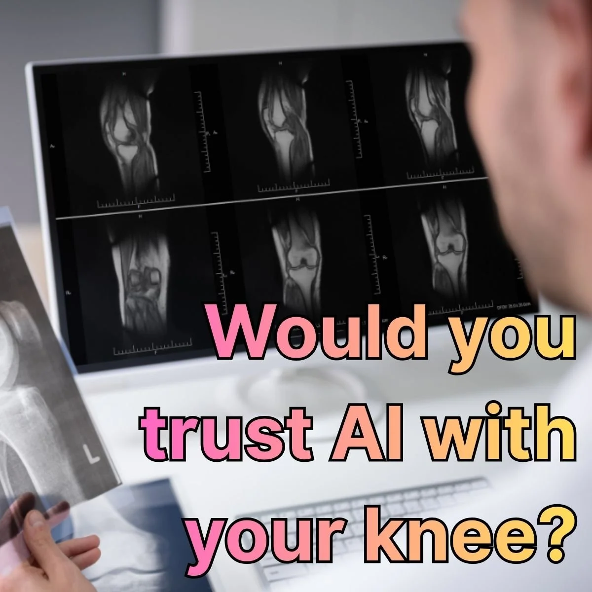 When My Knee Injury Revealed the Future of AI in Manufacturing