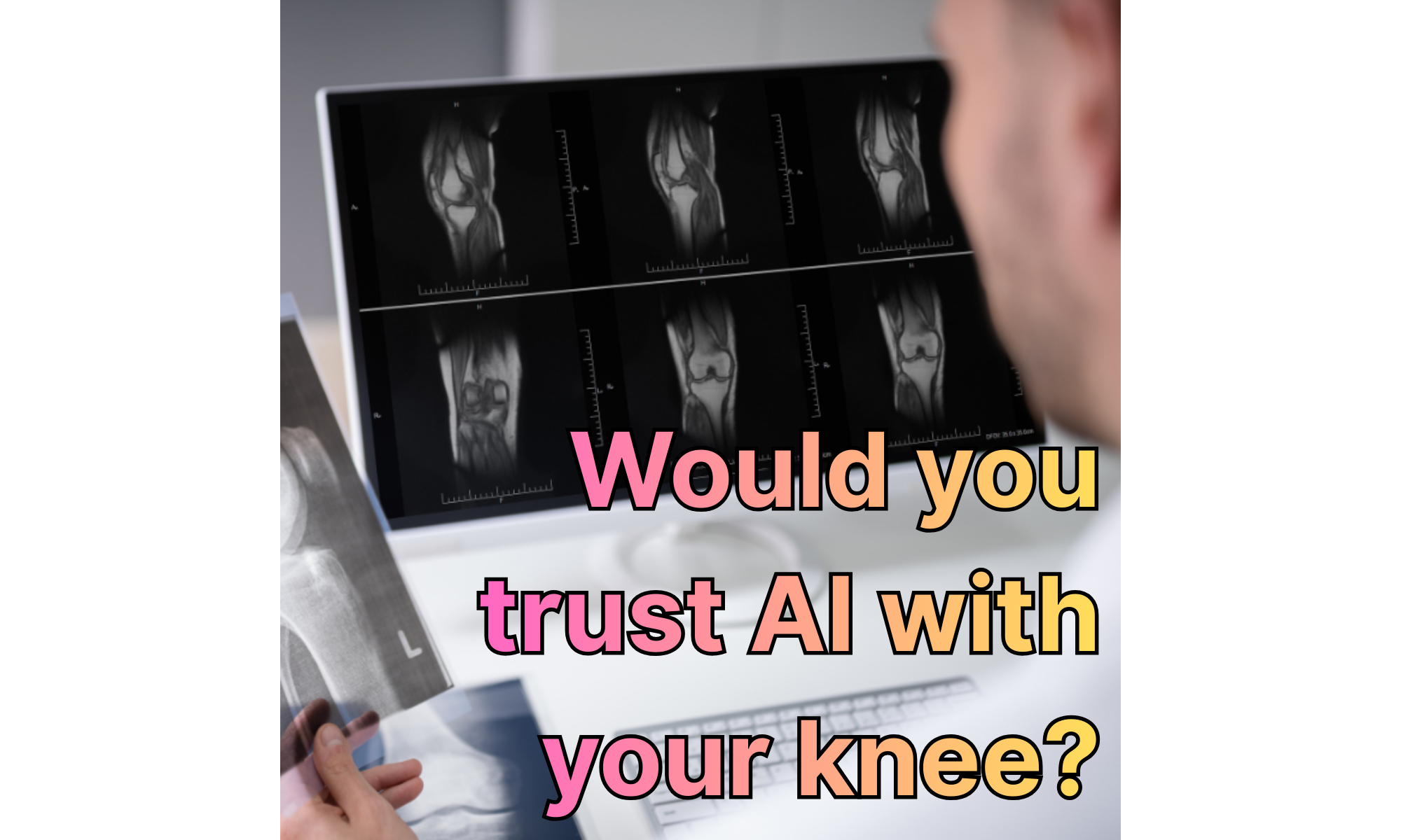 When My Knee Injury Revealed the Future of AI in Manufacturing