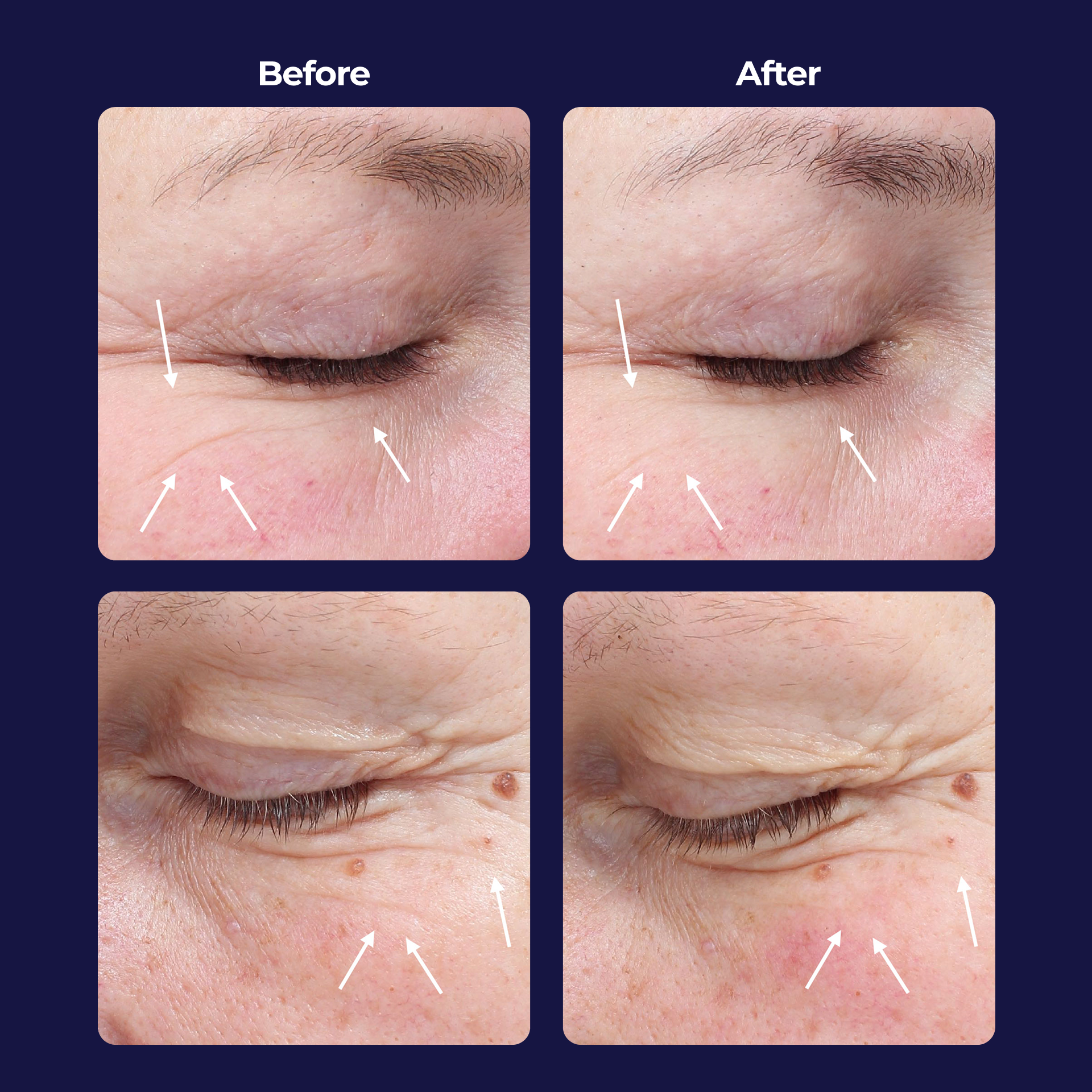 Product Image - Reverse Longitude PM Serum-Shot - Before And Afters.png