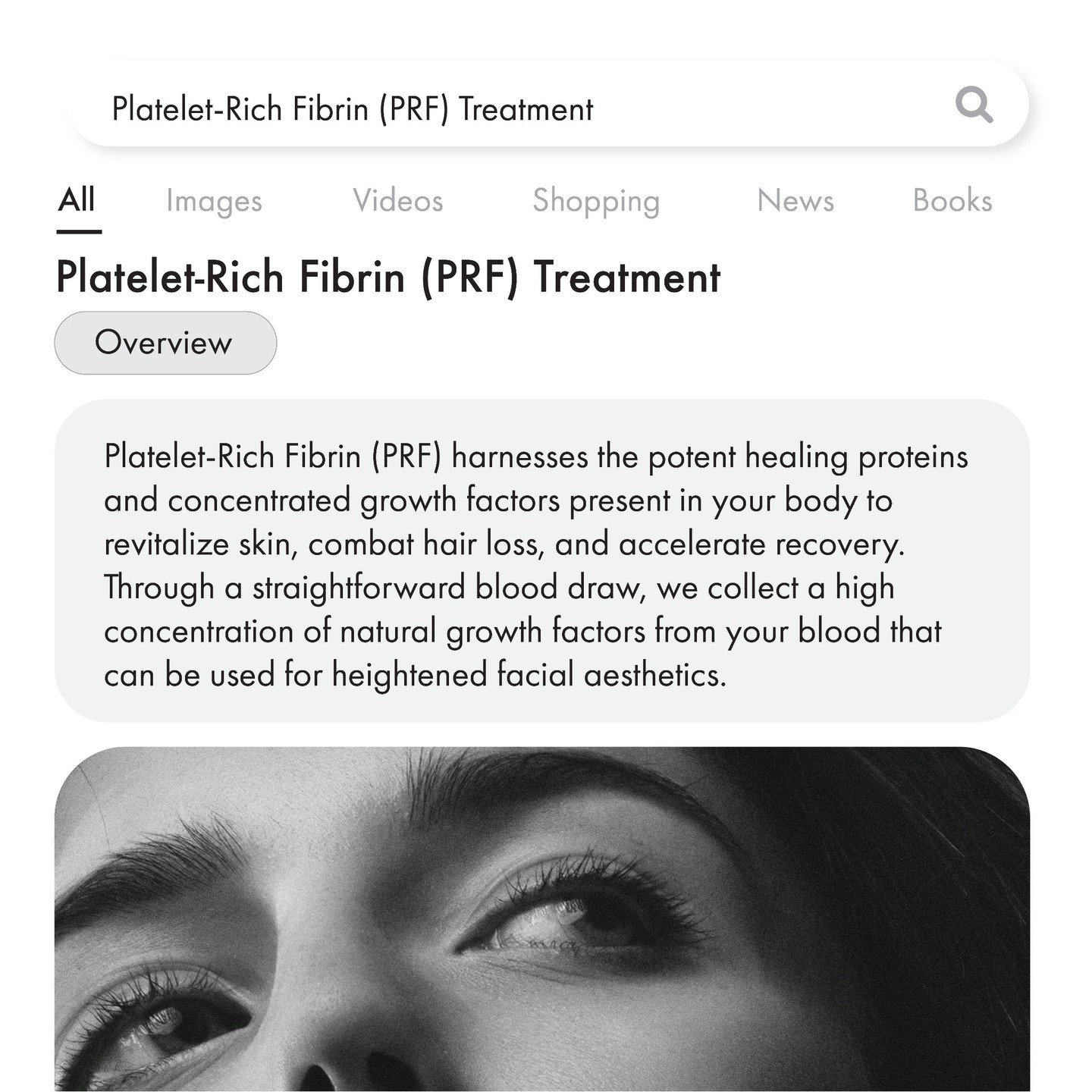 Unlock the secret to rejuvenated skin and luscious locks with Platelet-Rich Fibrin (PRF) Treatment. Say goodbye to hair loss and hello to radiant skin through the magic of your body's own healing proteins and growth factors. It's all about enhancing 