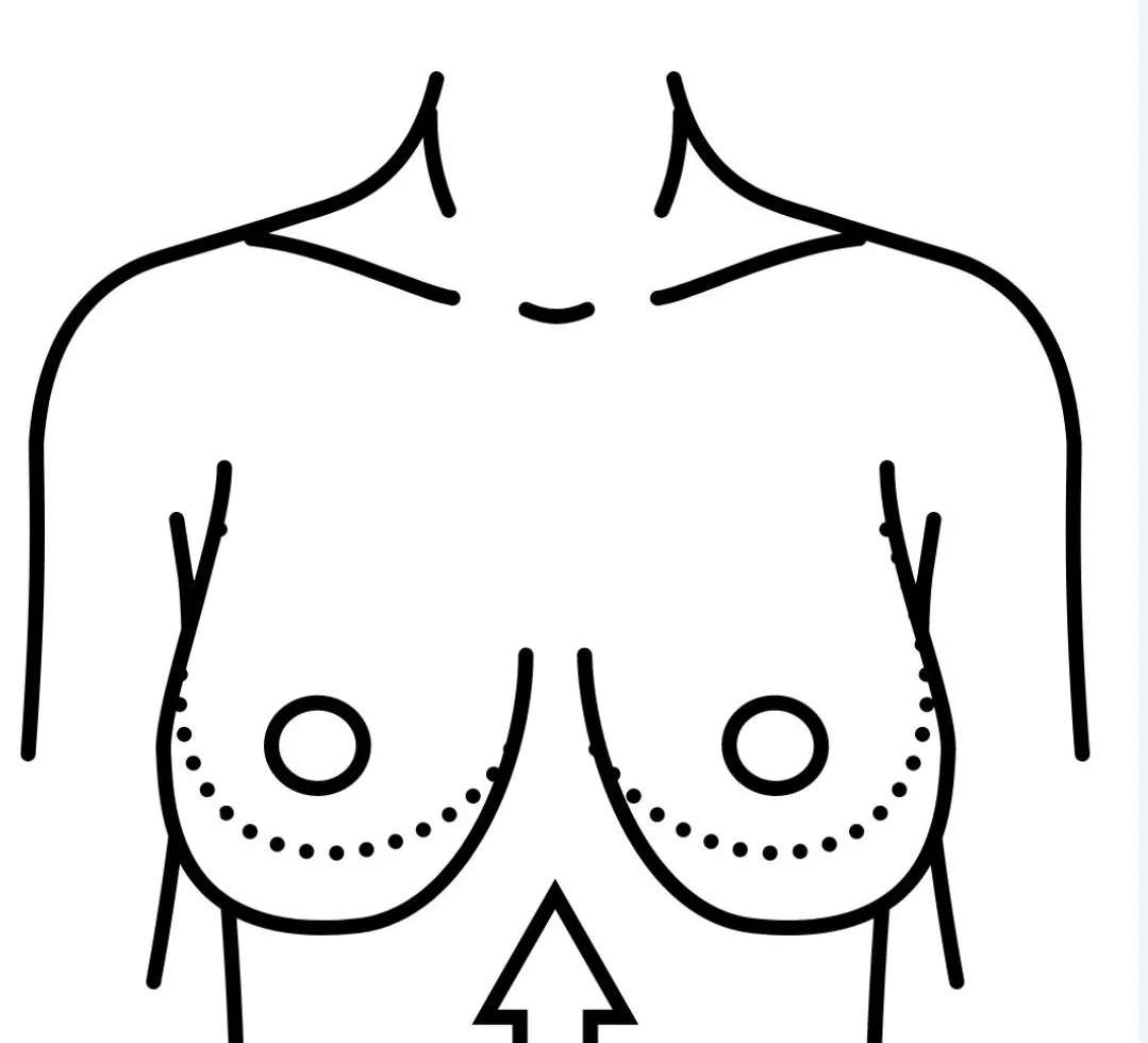 Breast Reduction Surgery in Sydney: What Patients Need to Know