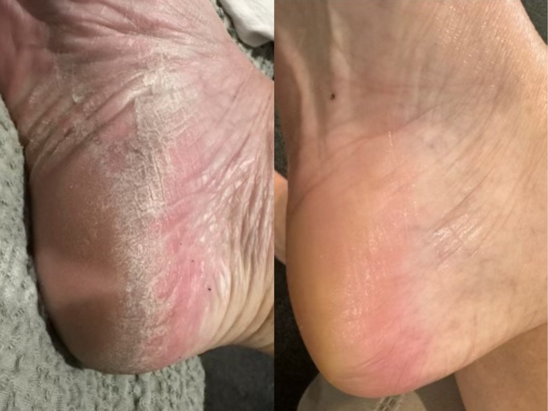 foot.jpg