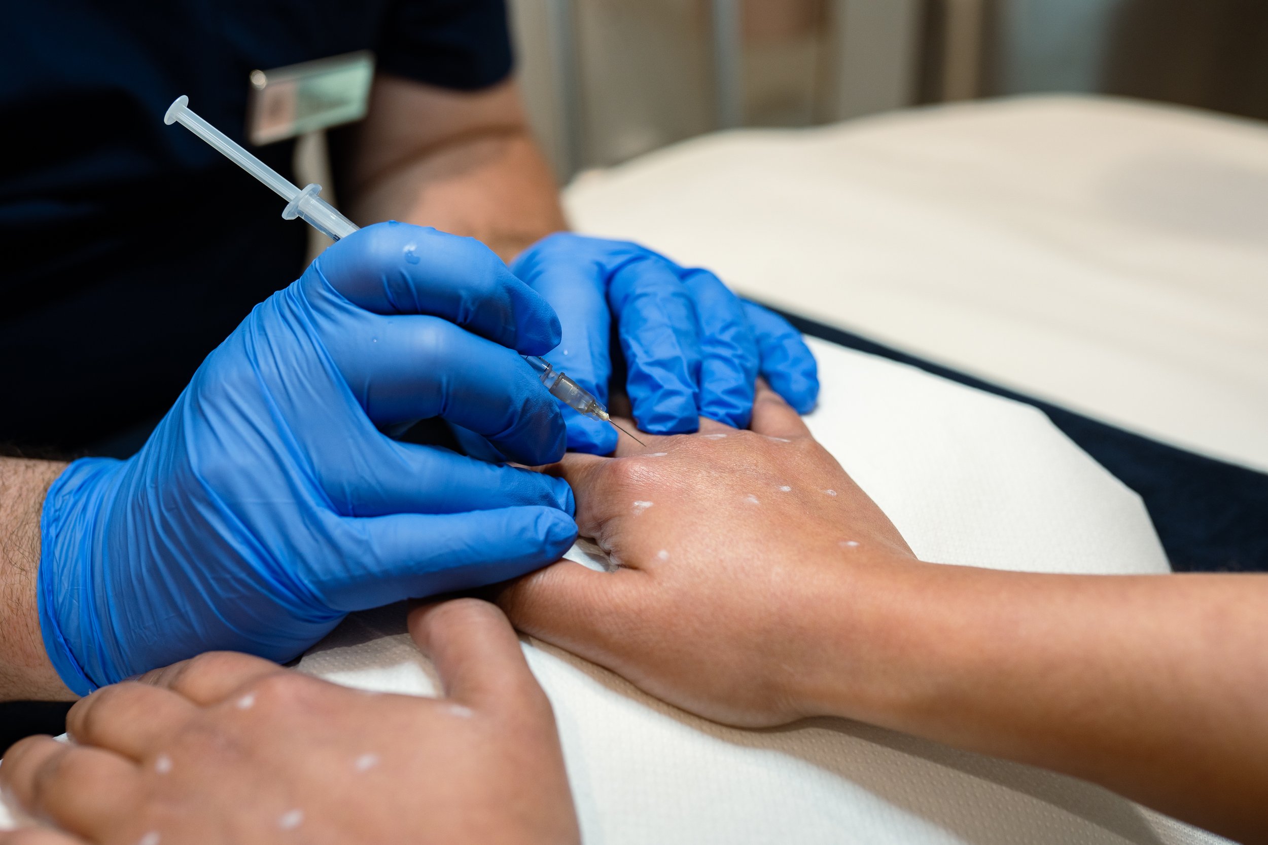 Hand Rejuvenation Research