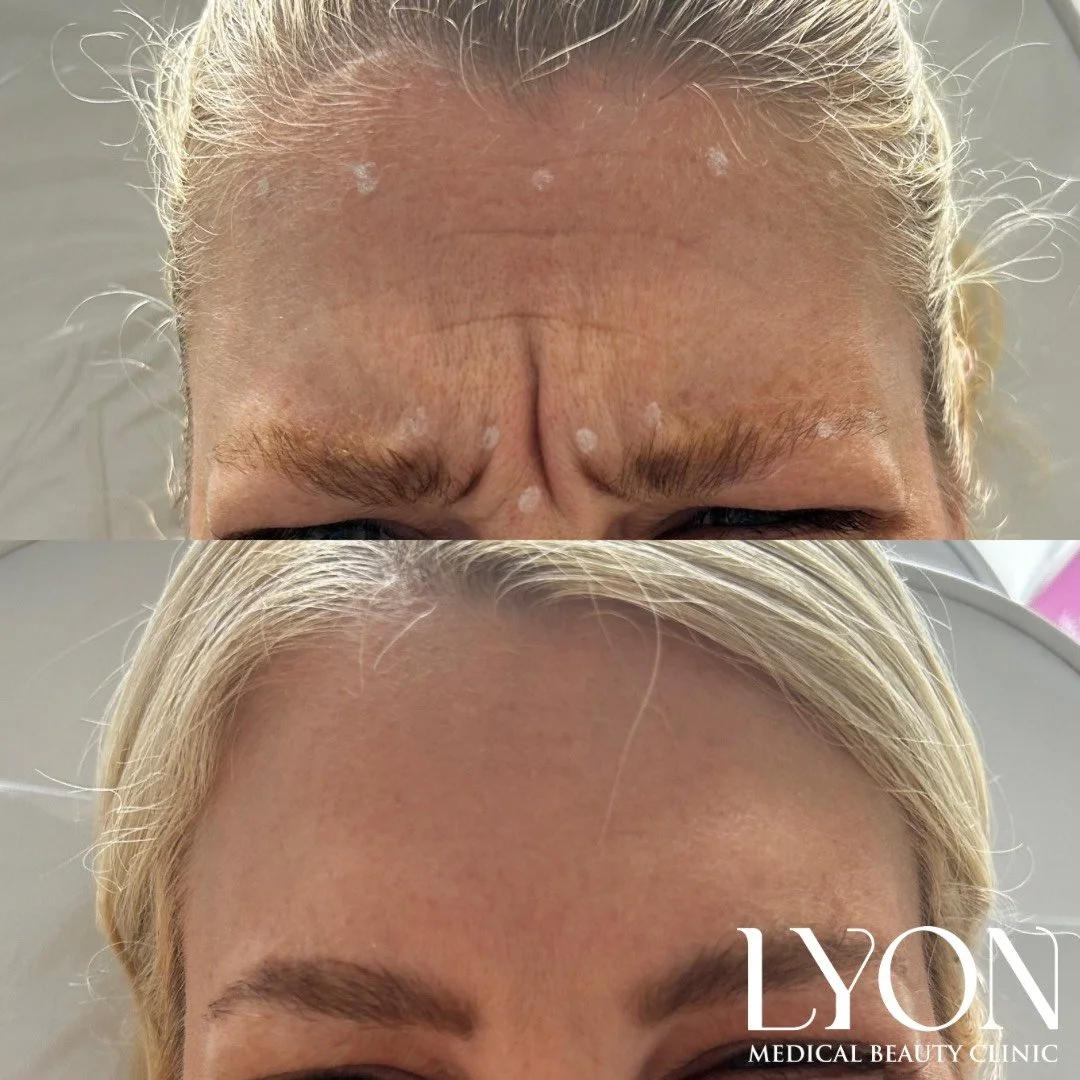 Copy of Before - 12.png