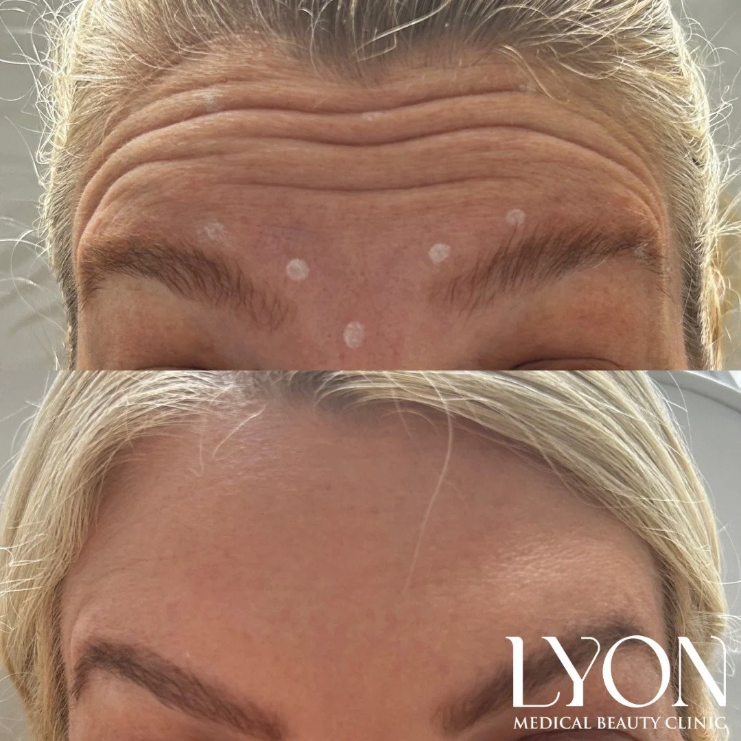 Copy of Before - 10.png