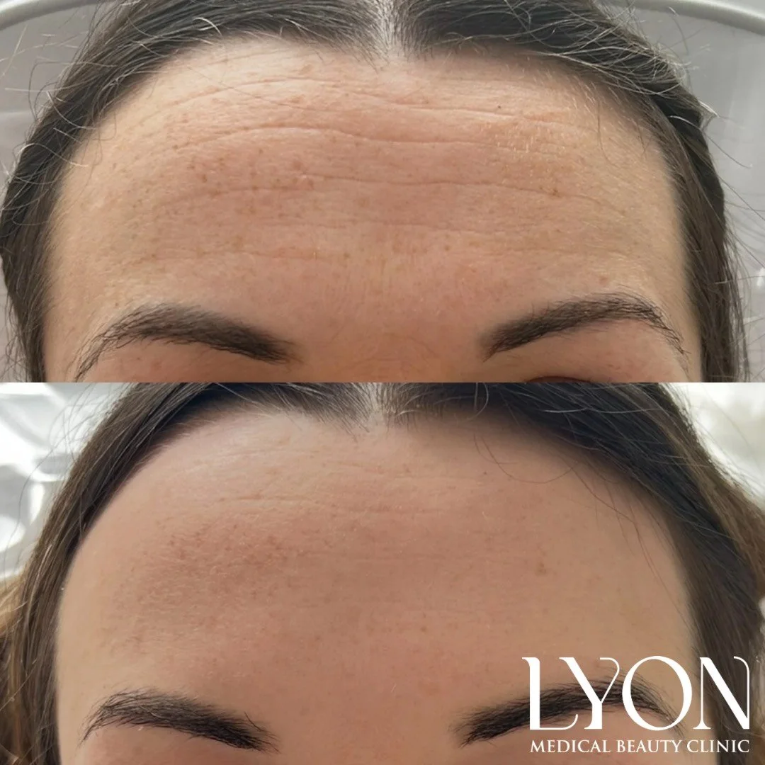 Copy of Before - 13.png