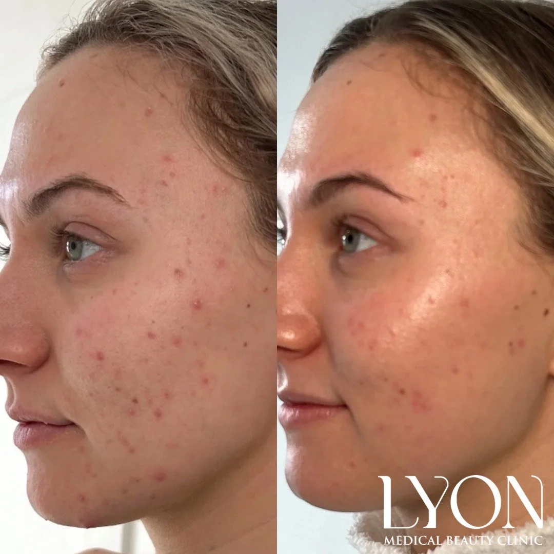 Copy of Before - 21.png