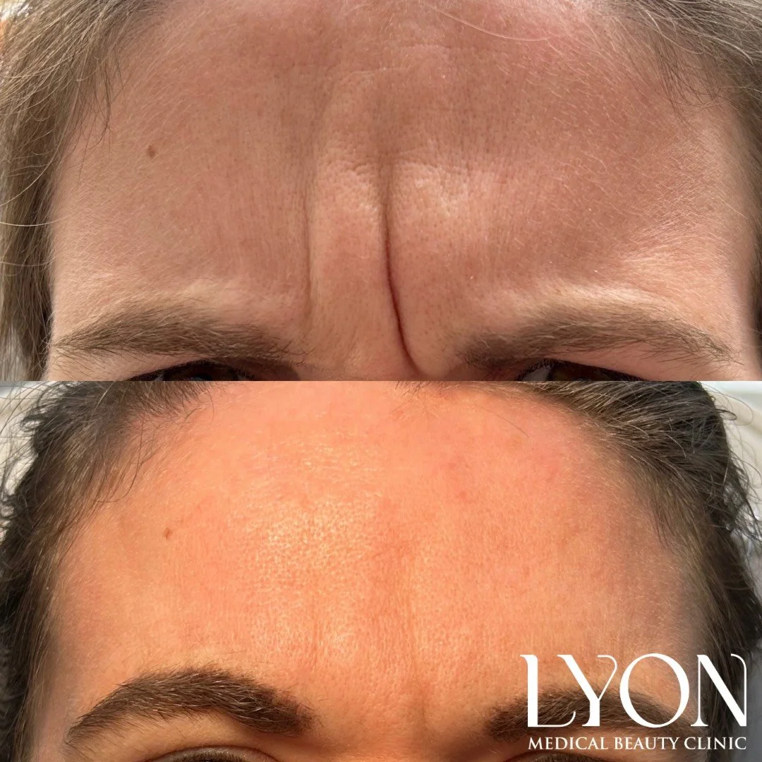 Copy of Before - 24.png