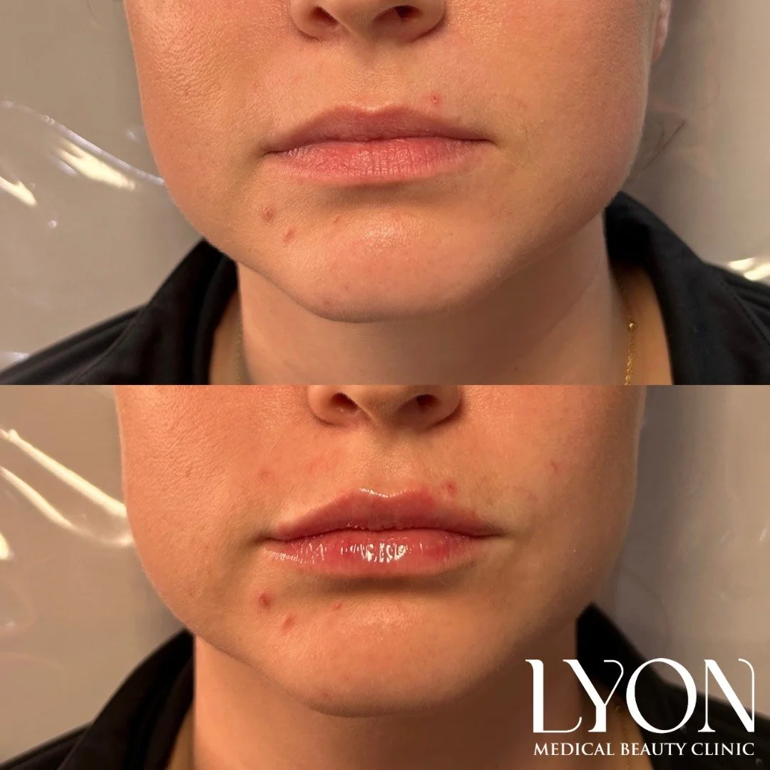 Copy of Before - 34.png