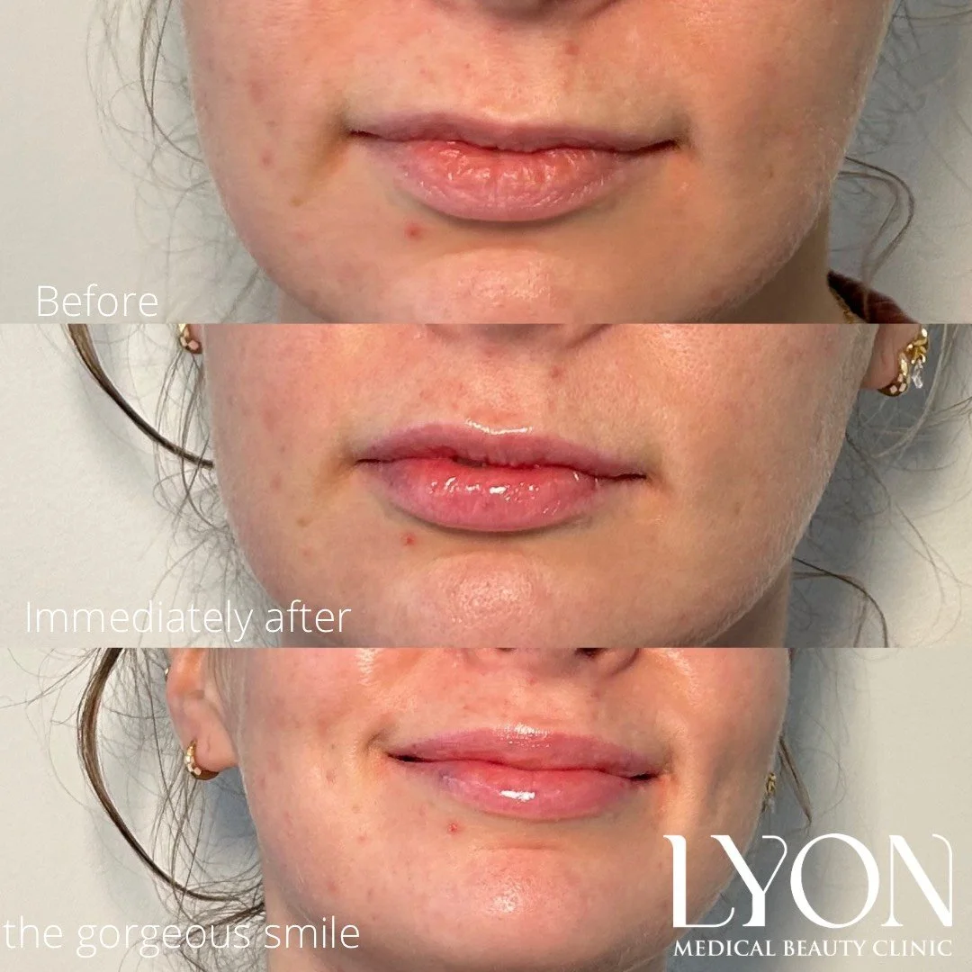 Copy of Before - 27.png