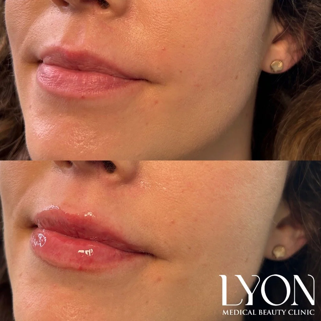 Copy of Before - 28.png