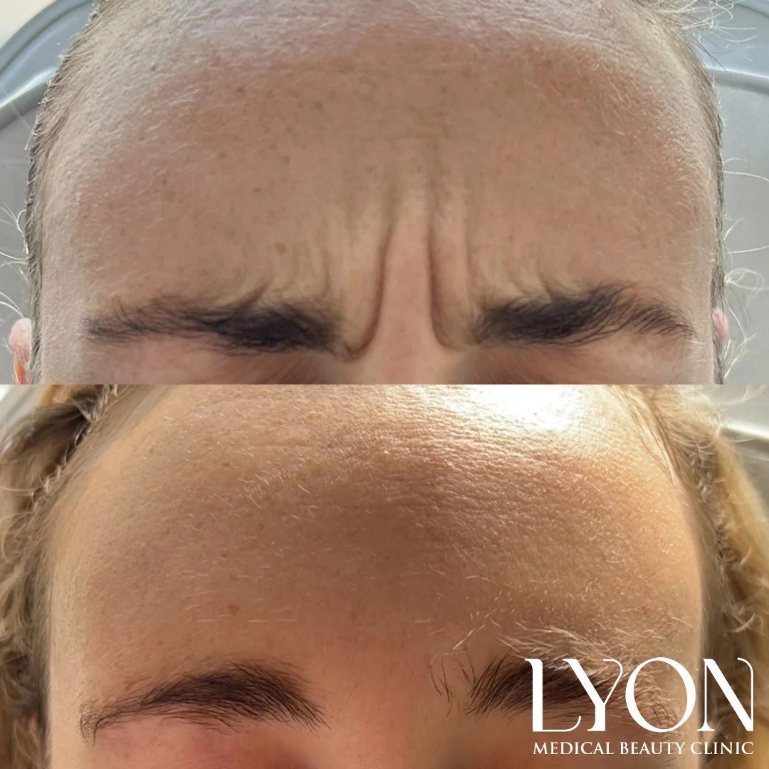 Copy of Before - 32.png