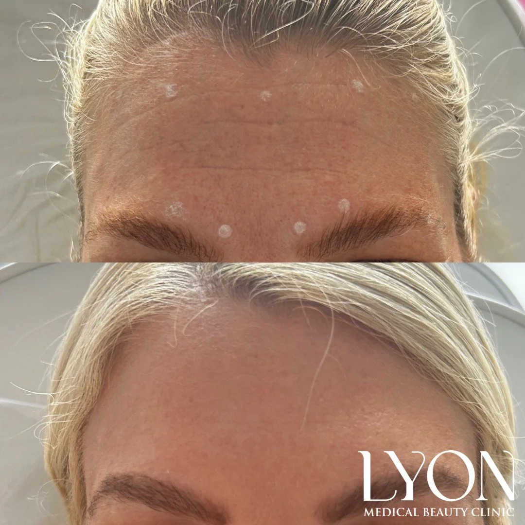 Copy of Before - 11.png