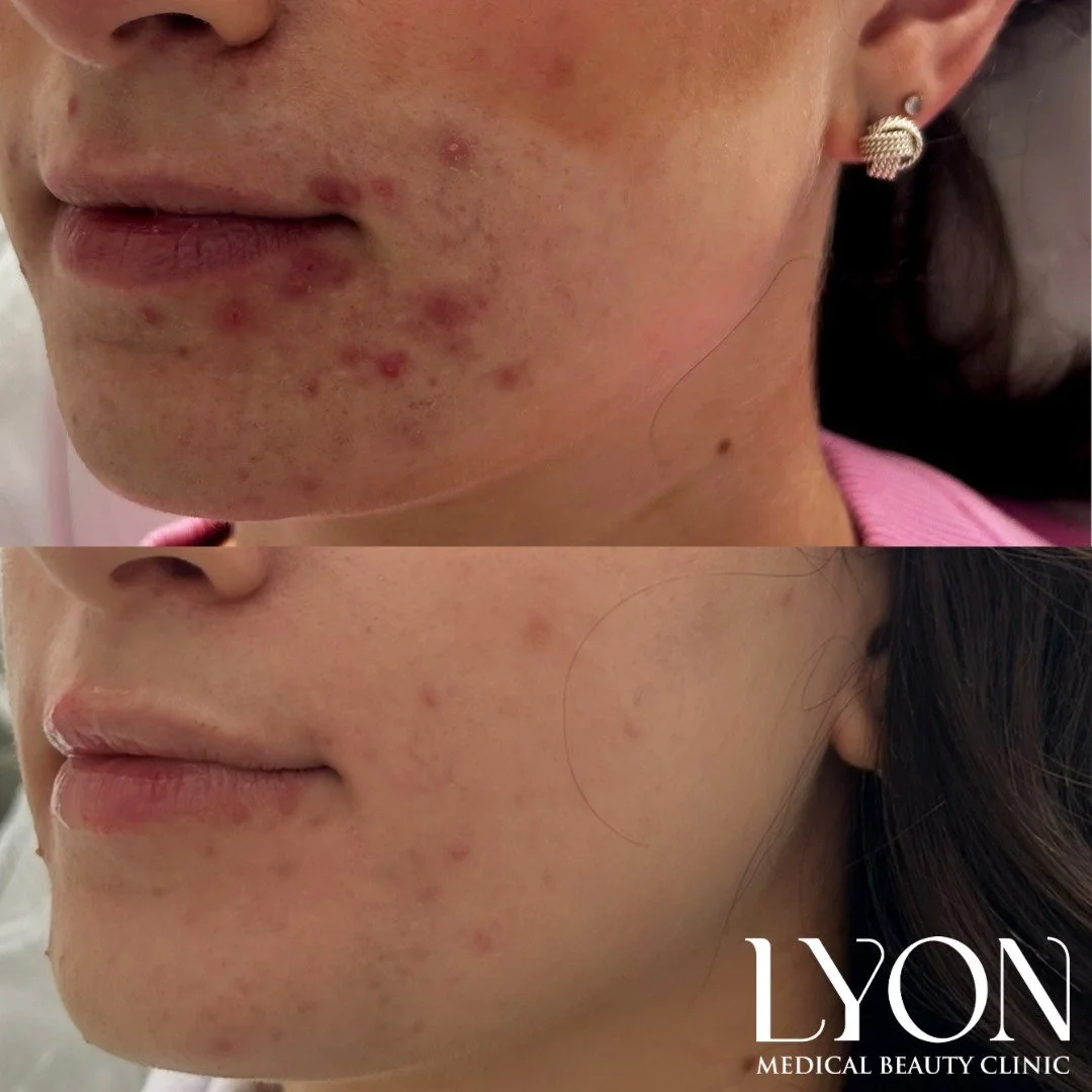 Copy of Before - 3.png