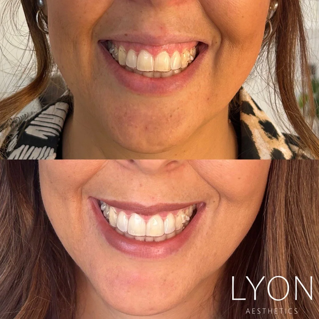 Copy of Before - 47.png