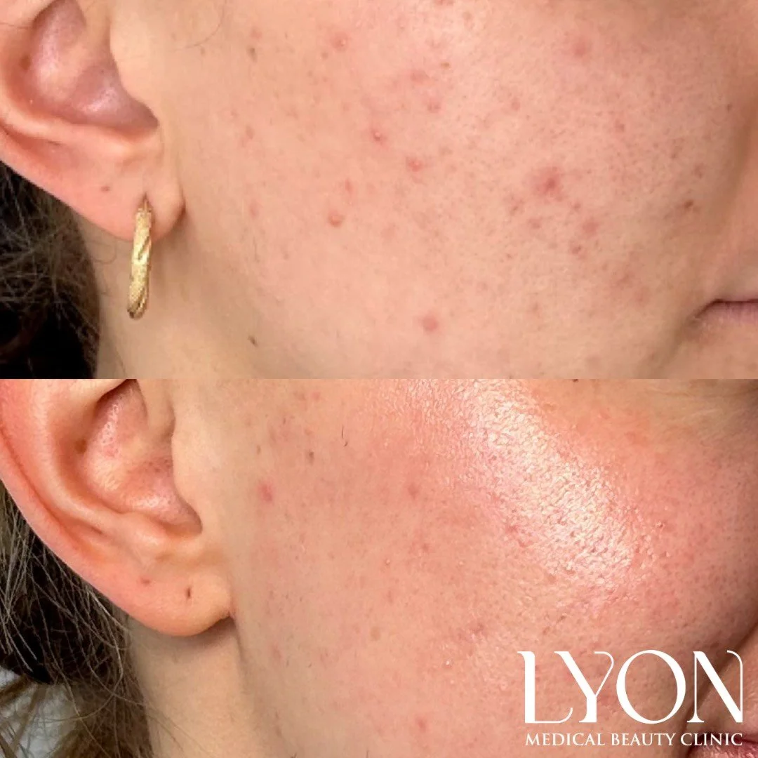 Copy of Before - 20.png