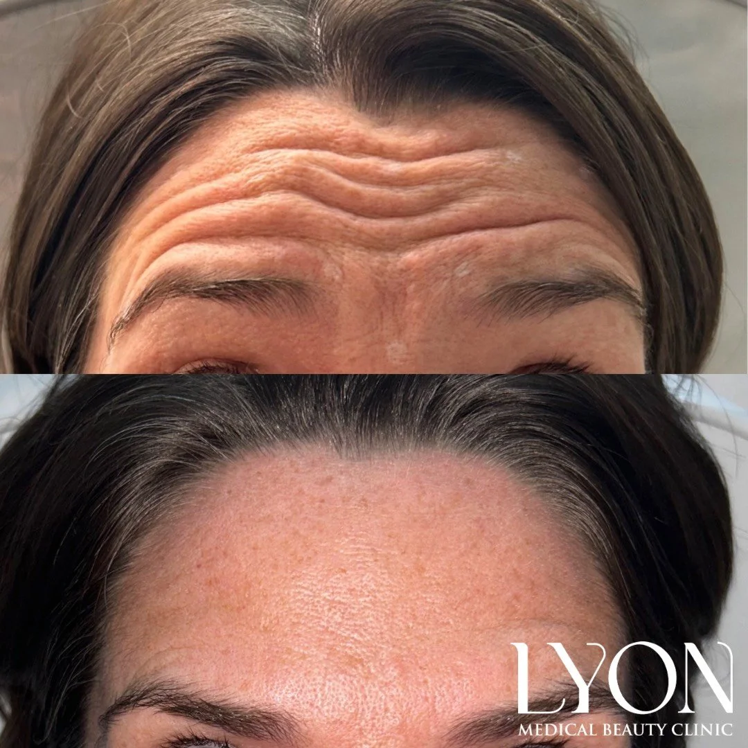 Copy of Before - 2.png