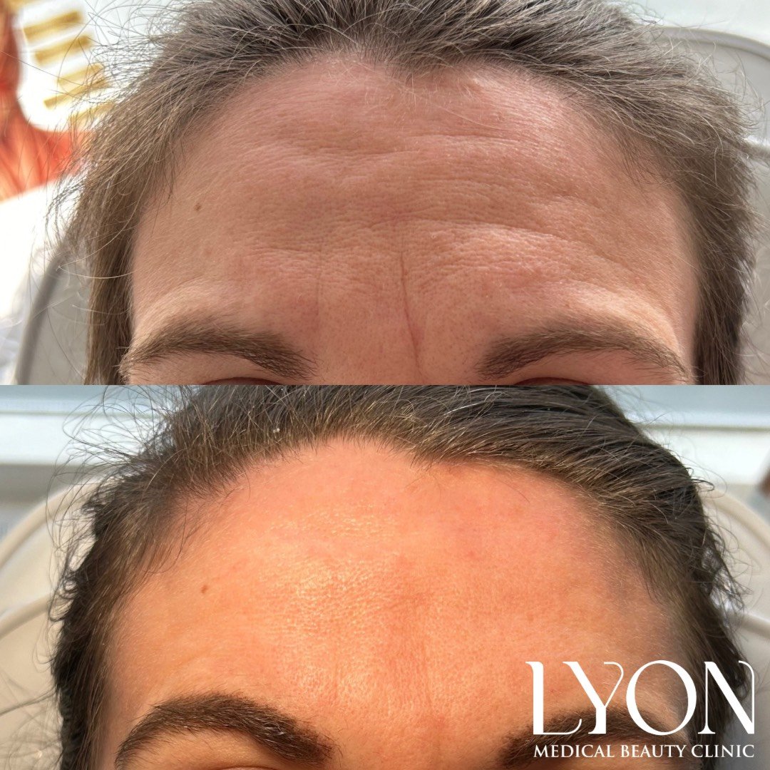 Copy of Before - 23.png