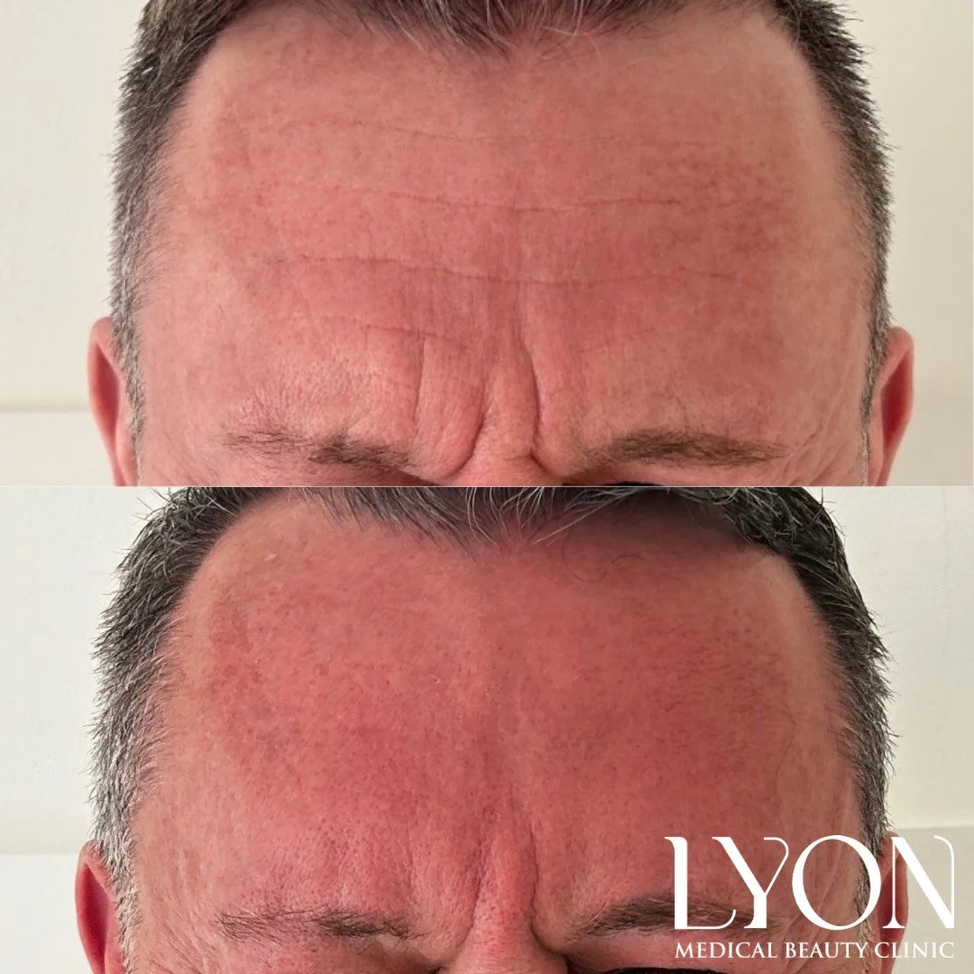 Copy of Before - 6.png