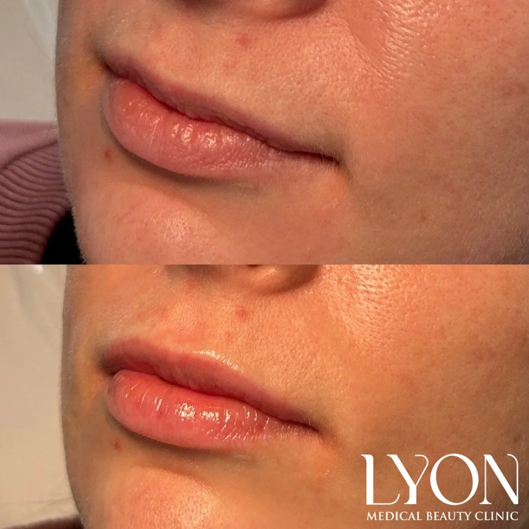 Copy of Before - 26.png