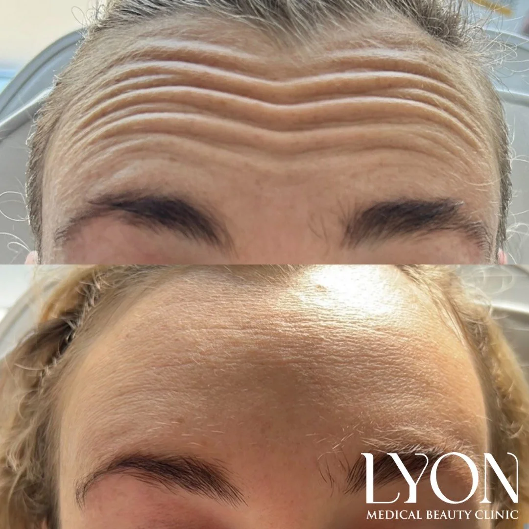 Copy of Before - 30.png