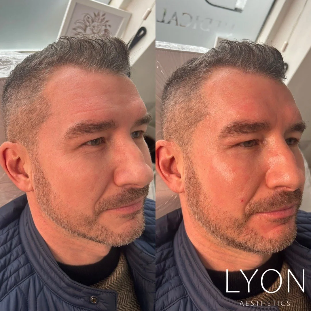 Copy of Before - 46.png