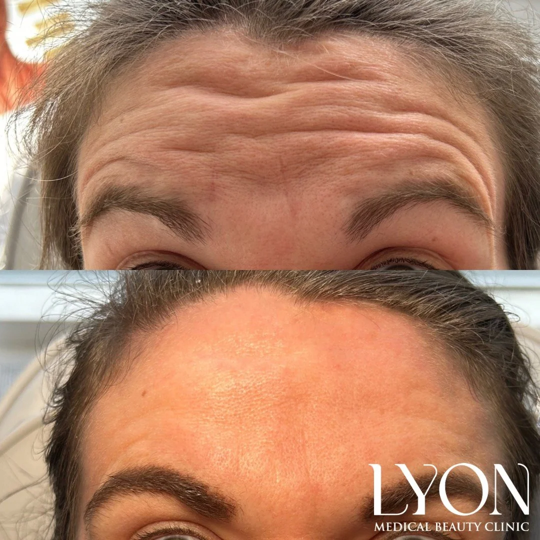 Copy of Before - 25.png