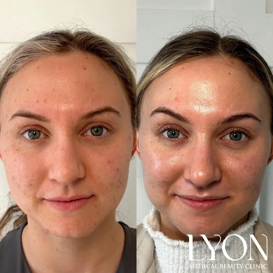 Copy of Before - 22.png