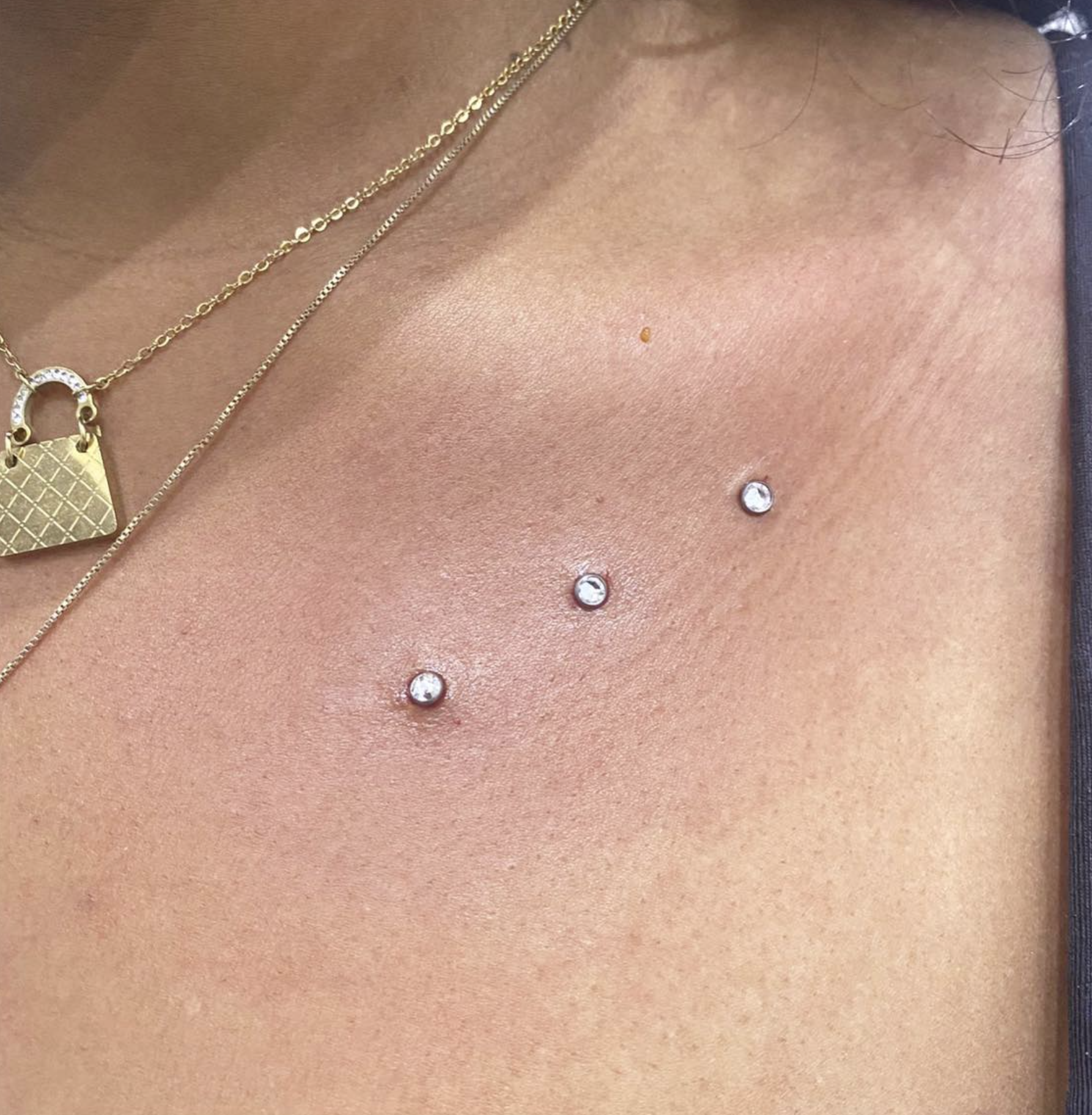 Microdermal : 70€