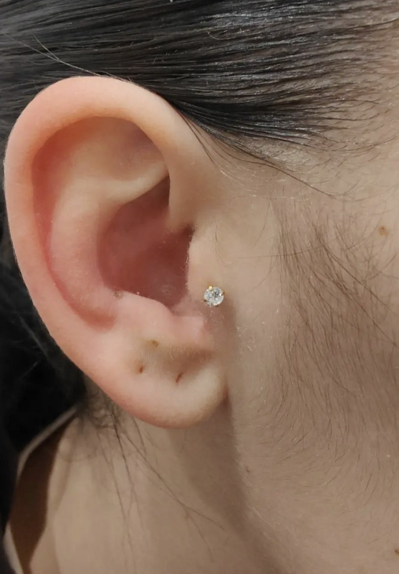 Tragus 2.png
