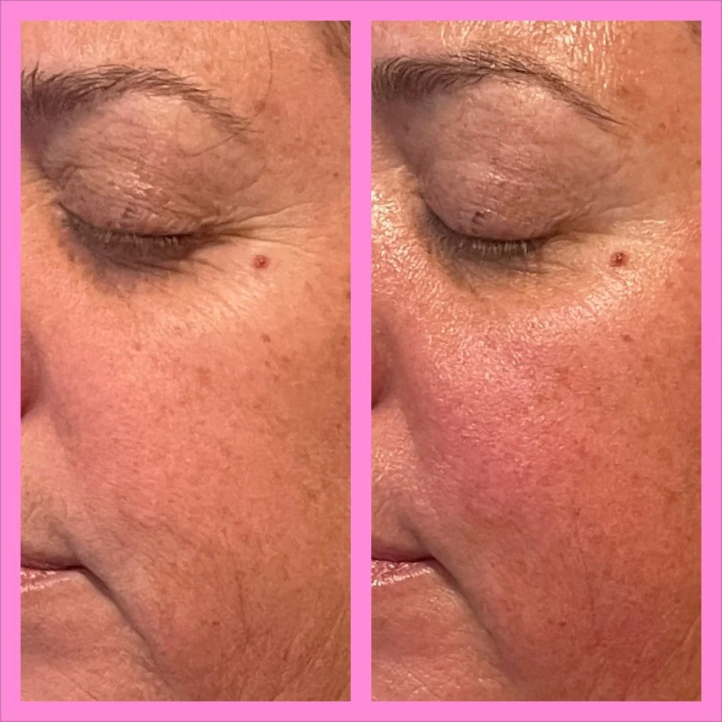 Myofascial Release Facial Massage in Oswego, NY