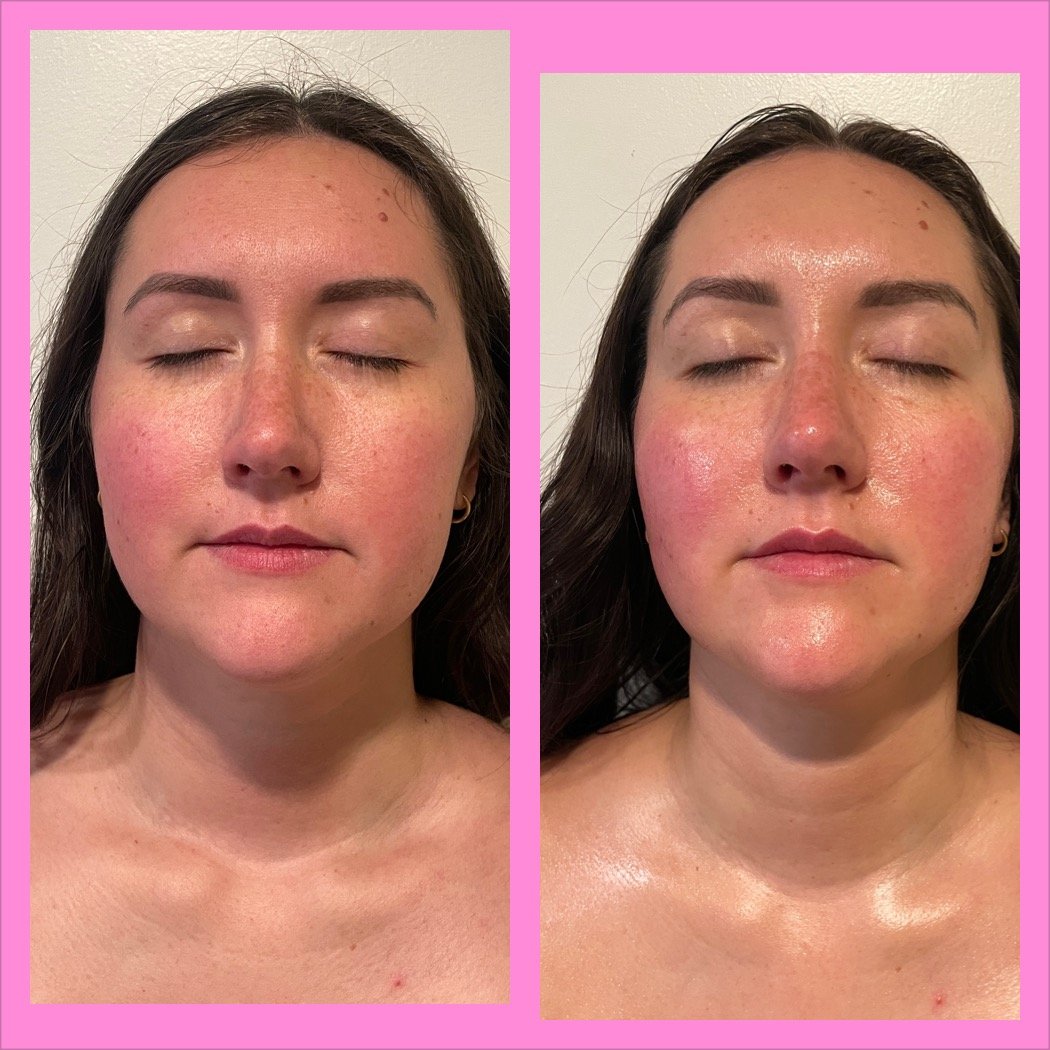 Facials In Oswego, NY