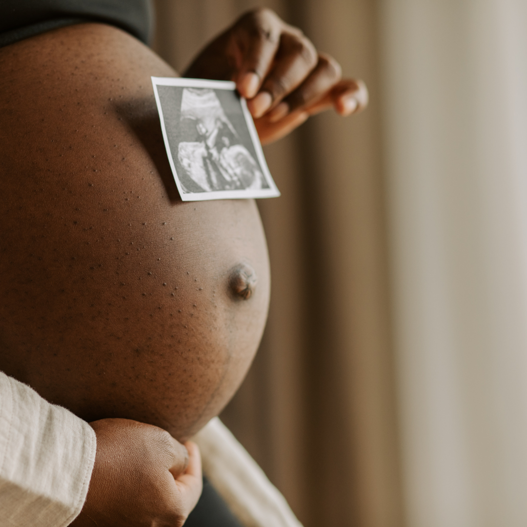 Questions to Ask Before Hiring a Doula