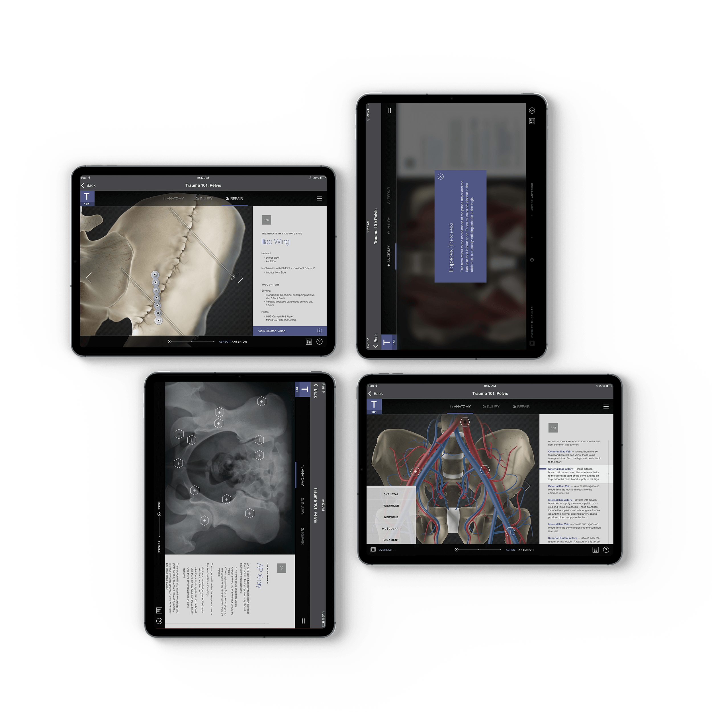 (1/3) Stryker Orthopedics Sales Personnel Education IPad App