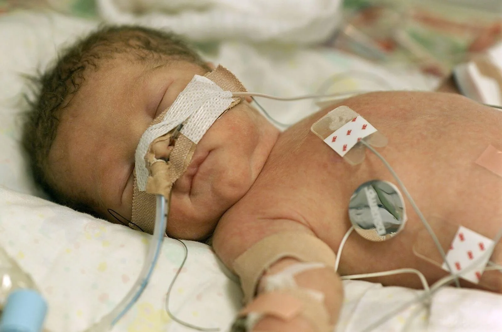 bigstock-Premature-Baby-5351417.jpg