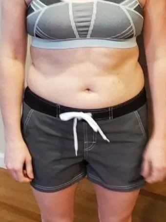 Medical weight loss after result
