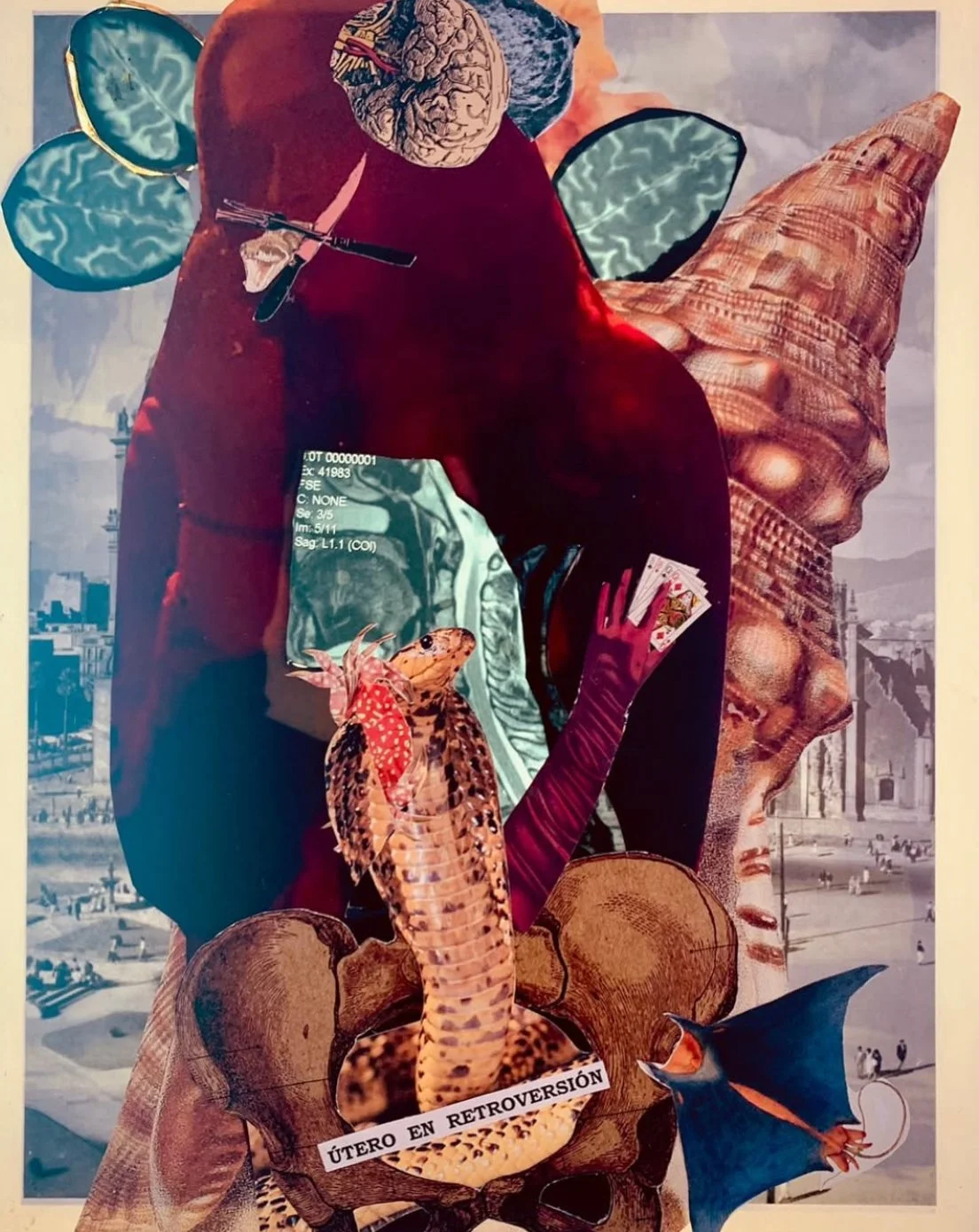 "Pensamientos y útero en retroversión" 2024