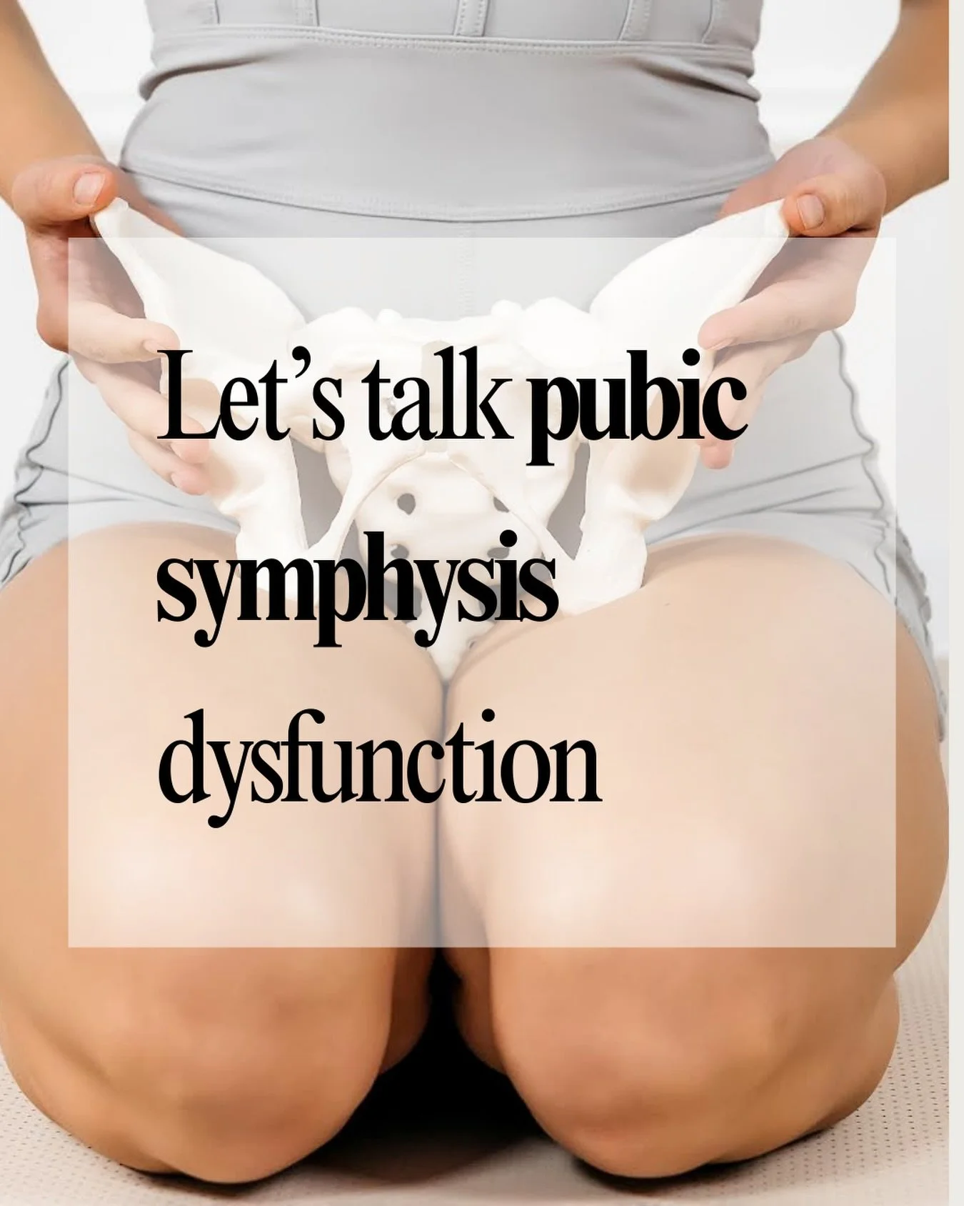 ⭐️
Pubic symphysis dysfunction, also called pelvic girdle pain, is a condition that causes pain and discomfort at the pubic symphysis. The pubic symphysis is the joint in the front of the pelvis that connects the right and the left sides together. In