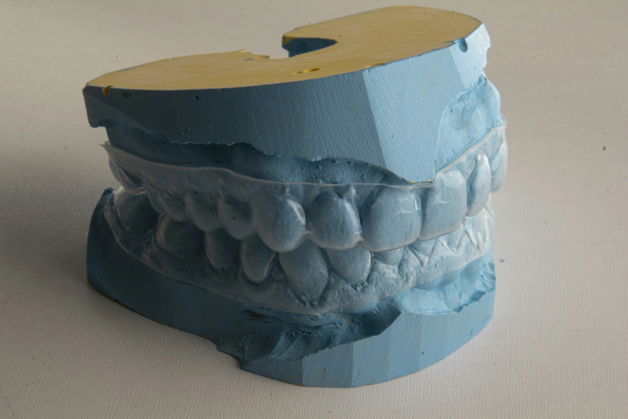 Orthodontics and Obstructive Sleep Apnoea: Why Screening and Airway Management Matter