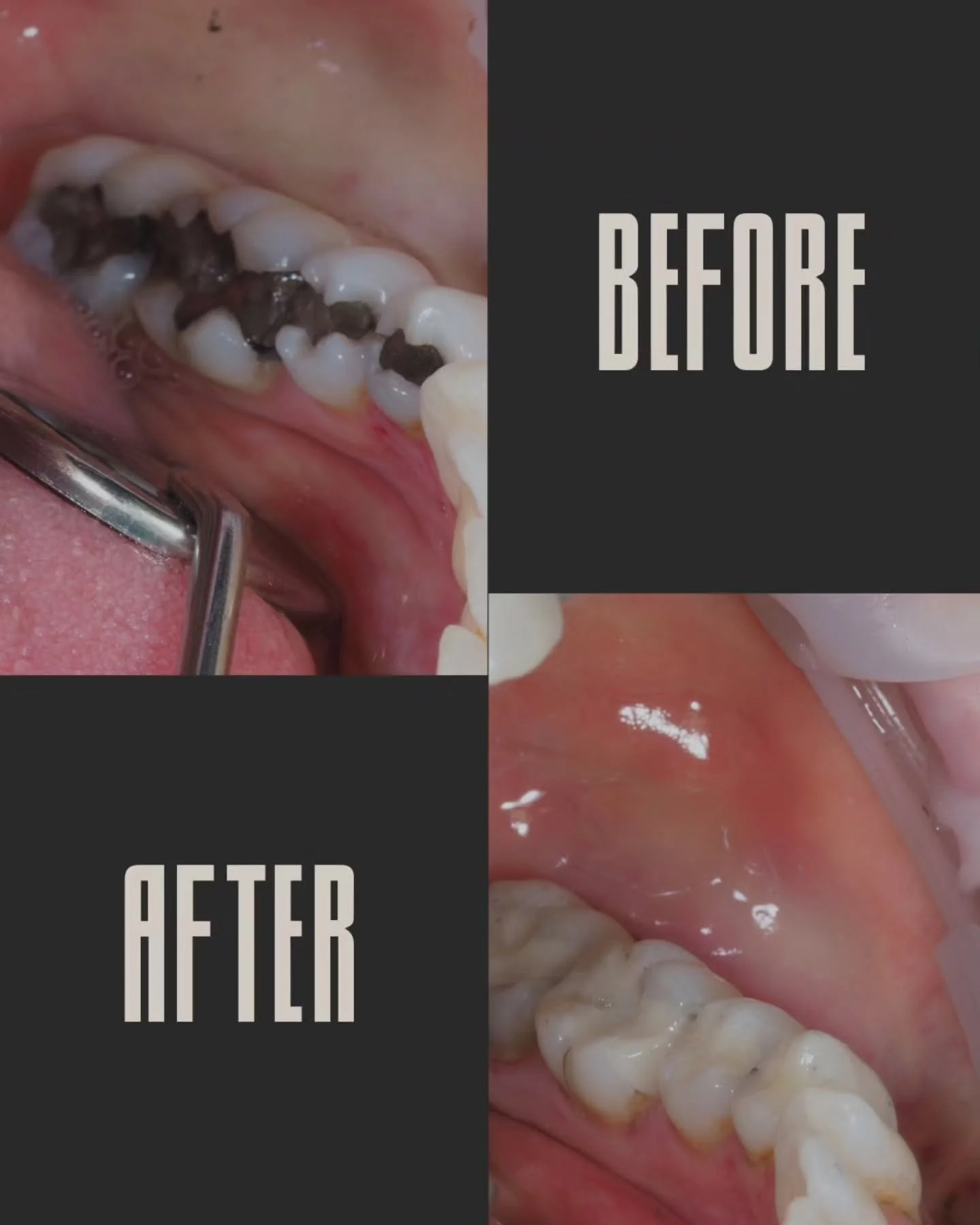 Ever thought about freshening up those old amalgams for something more natural?