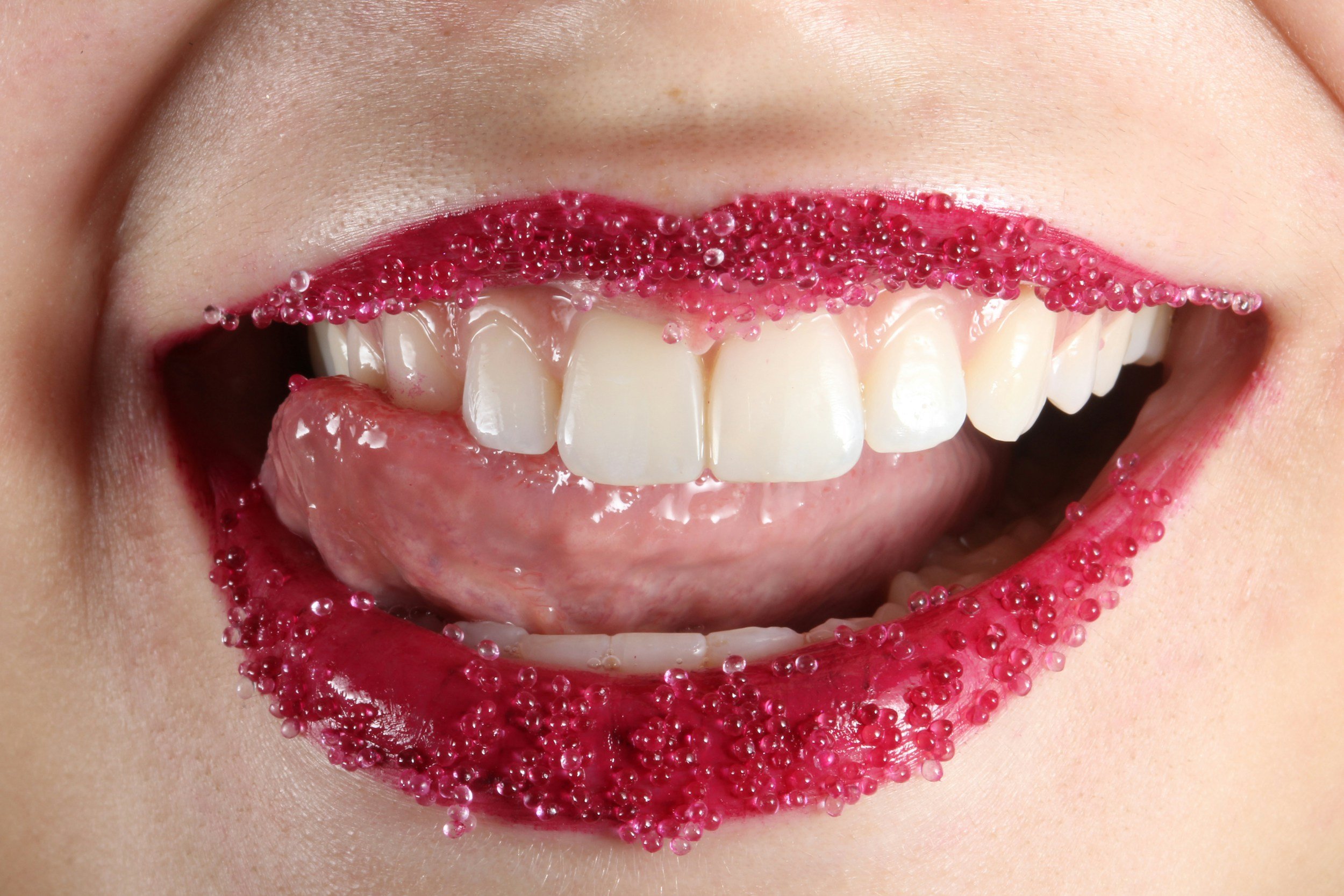 White Spots on Your Teeth — What Are They, and What Can Be Done?