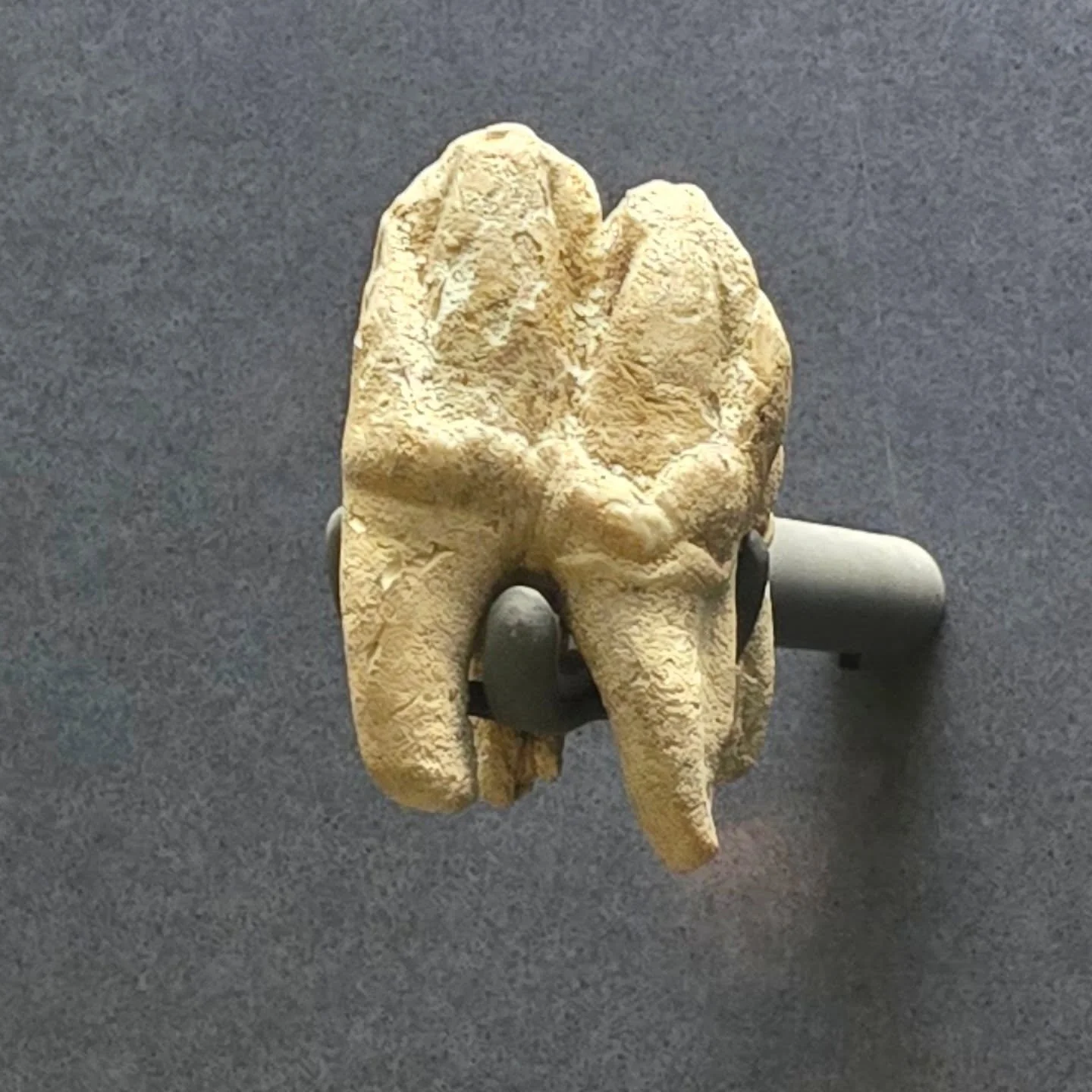 Is this a human molar?