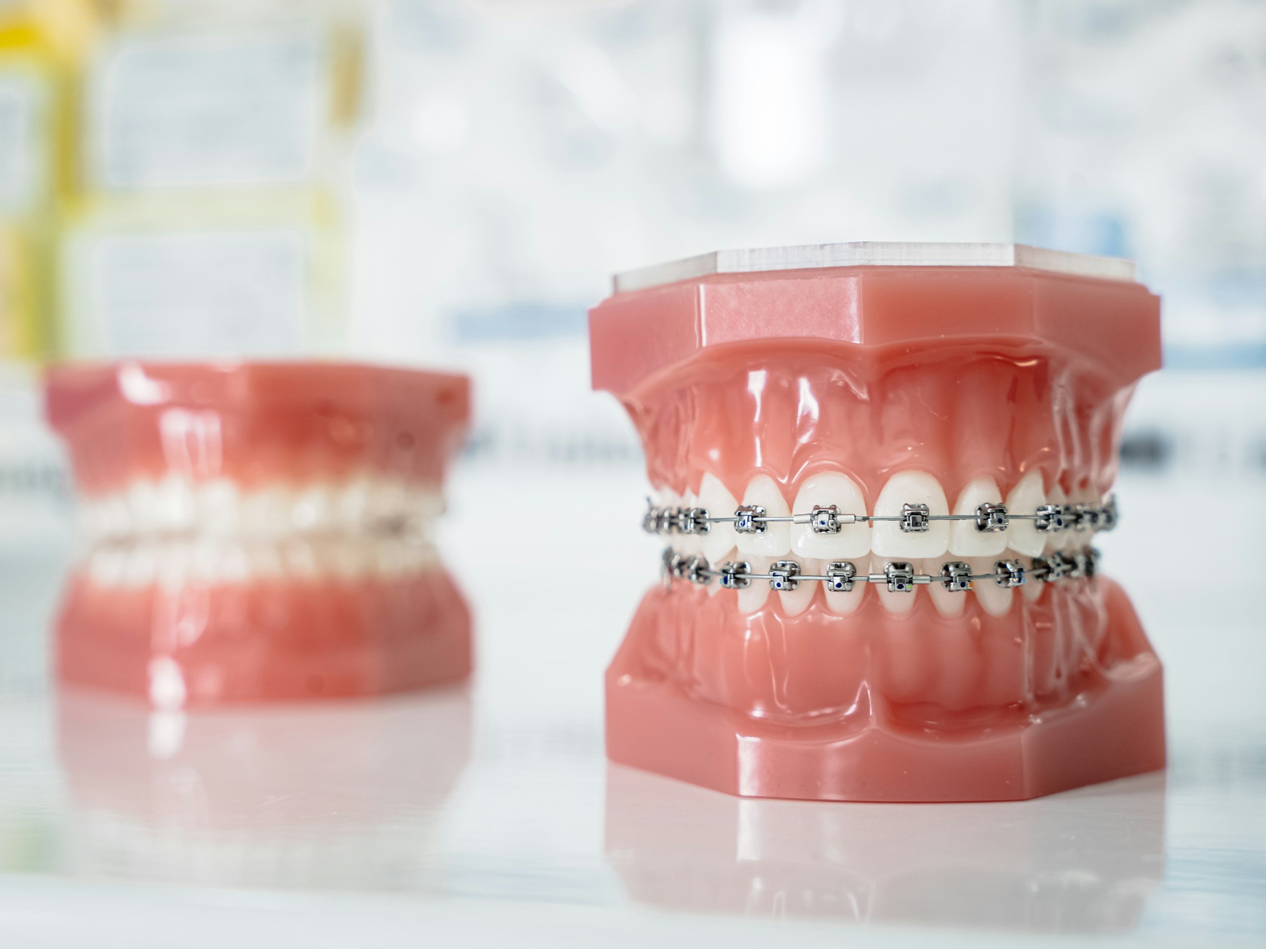 Is Your Child's Face Telling You Something? The Signs They May Need Early Interceptive Orthodontics