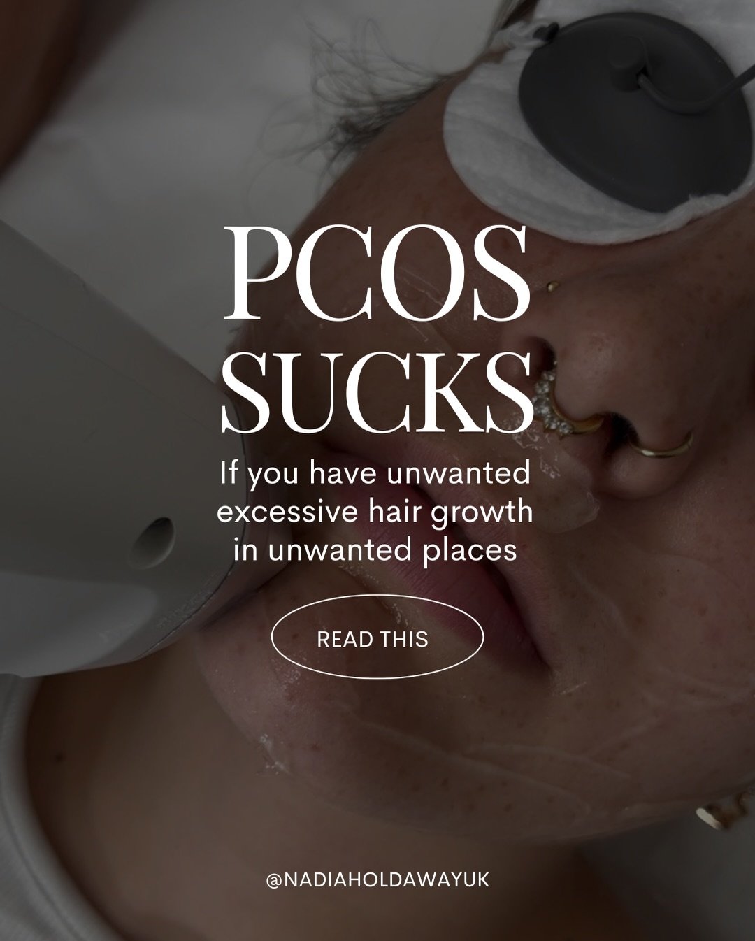 PCOS can be exhausting, physically, emotionally, and mentally. 

Unwanted or excessive hair growth in places you never asked for can really knock your confidence, and I want you to know this: you&rsquo;re not alone, and you&rsquo;re not being dramati