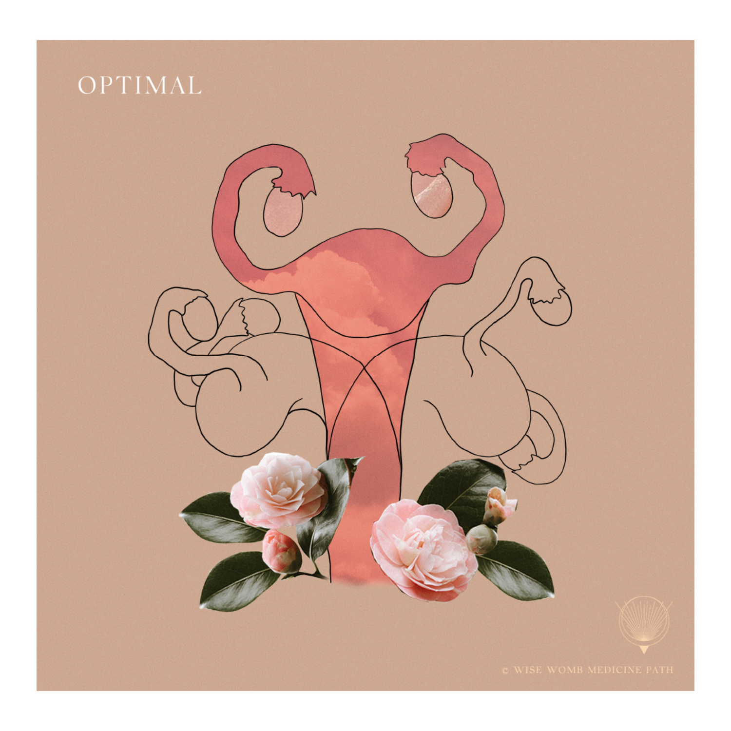 Symptoms of a Right &amp; Left Side Leaning Womb