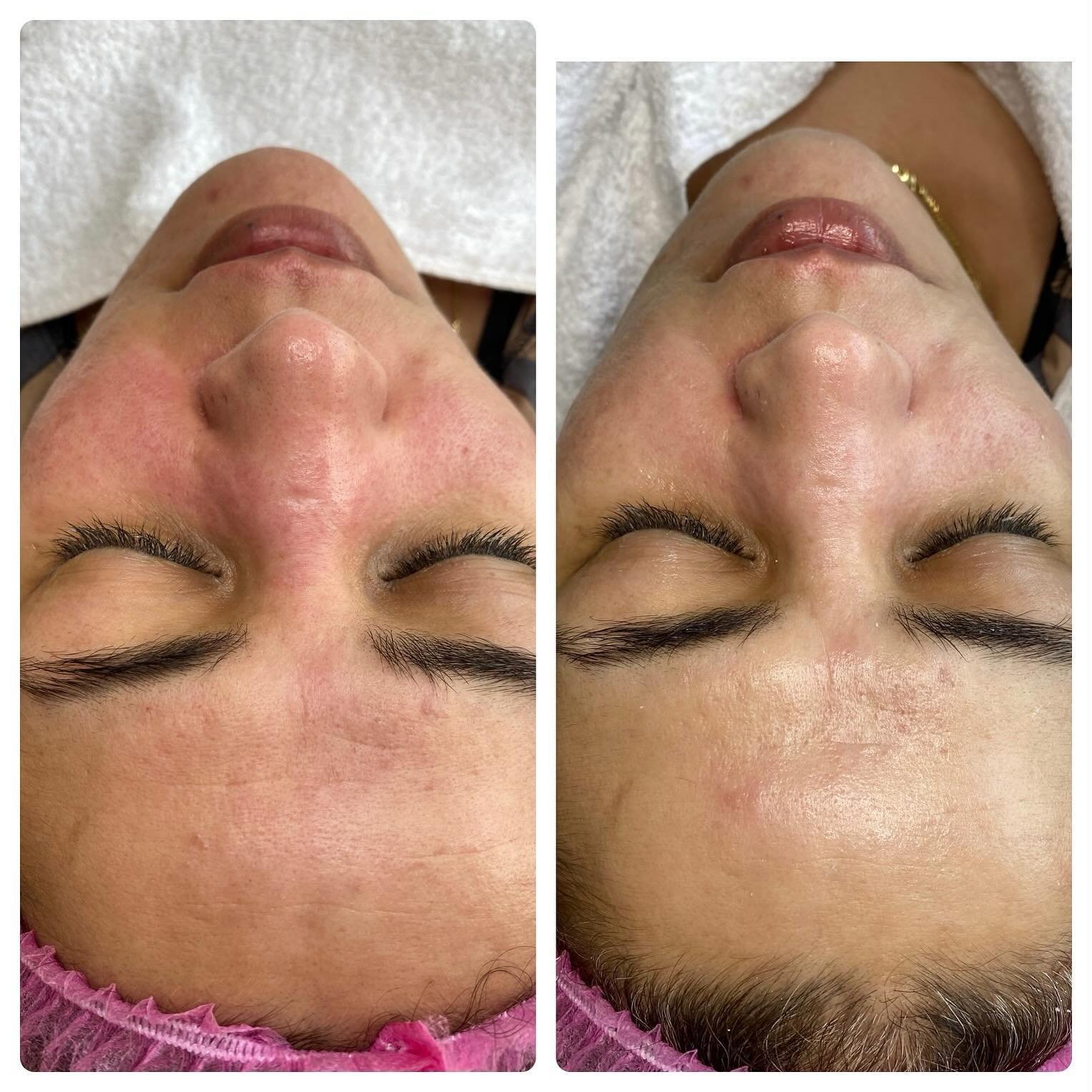 Feuchtigkeit Behandlung mit Wirkstoff Ampulle 🥰